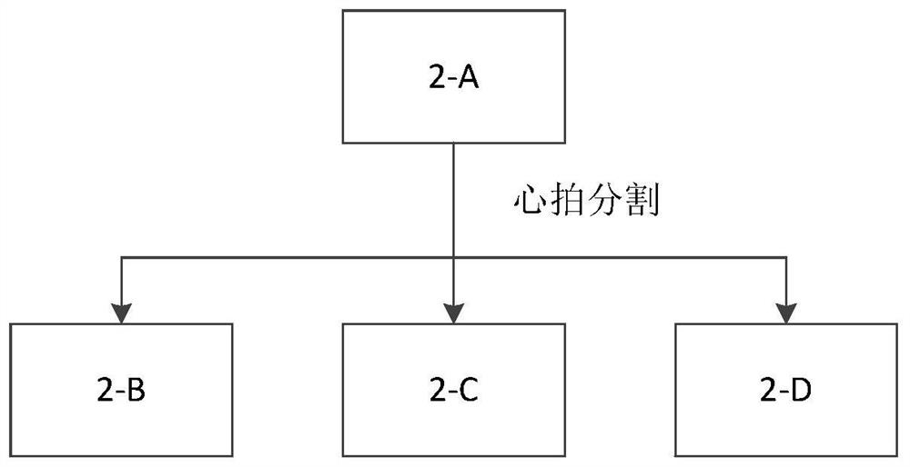 A ECG feature extraction method based on pcanet