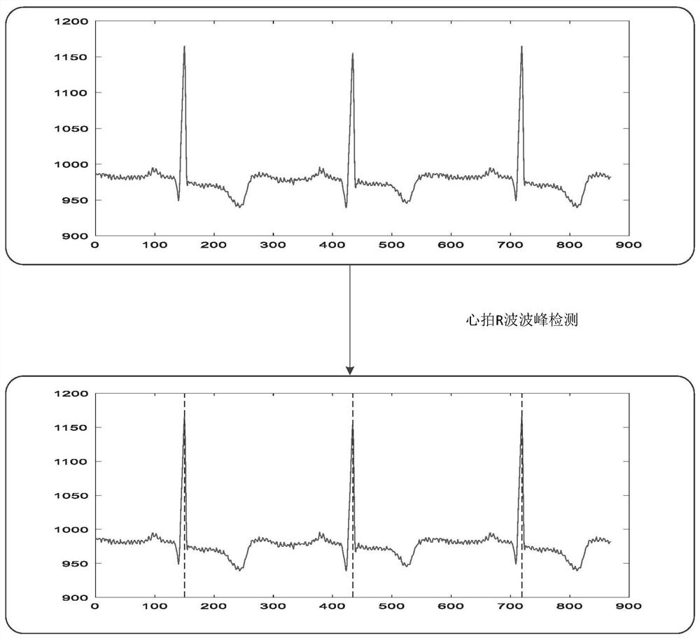 A ECG feature extraction method based on pcanet