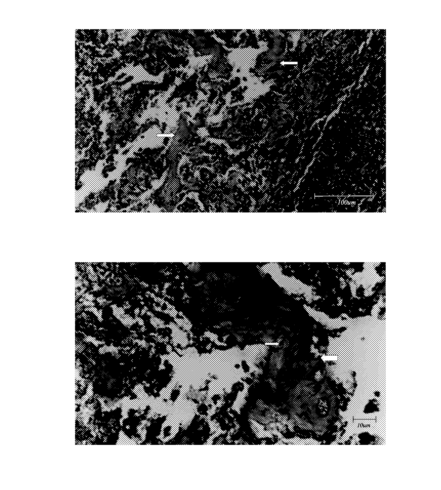 Method of inducing osteogensis and promoting osseointegration around an implant