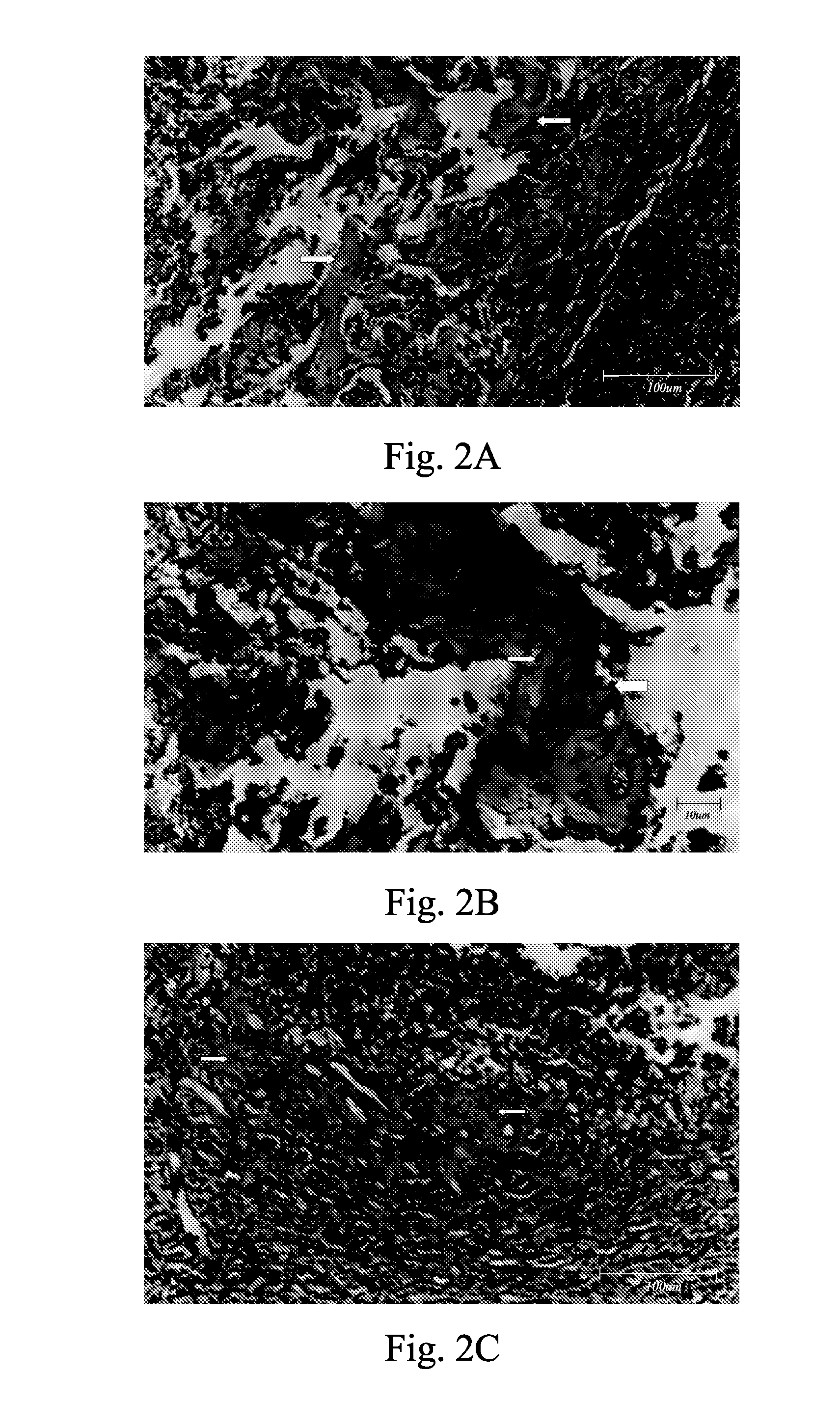 Method of inducing osteogensis and promoting osseointegration around an implant