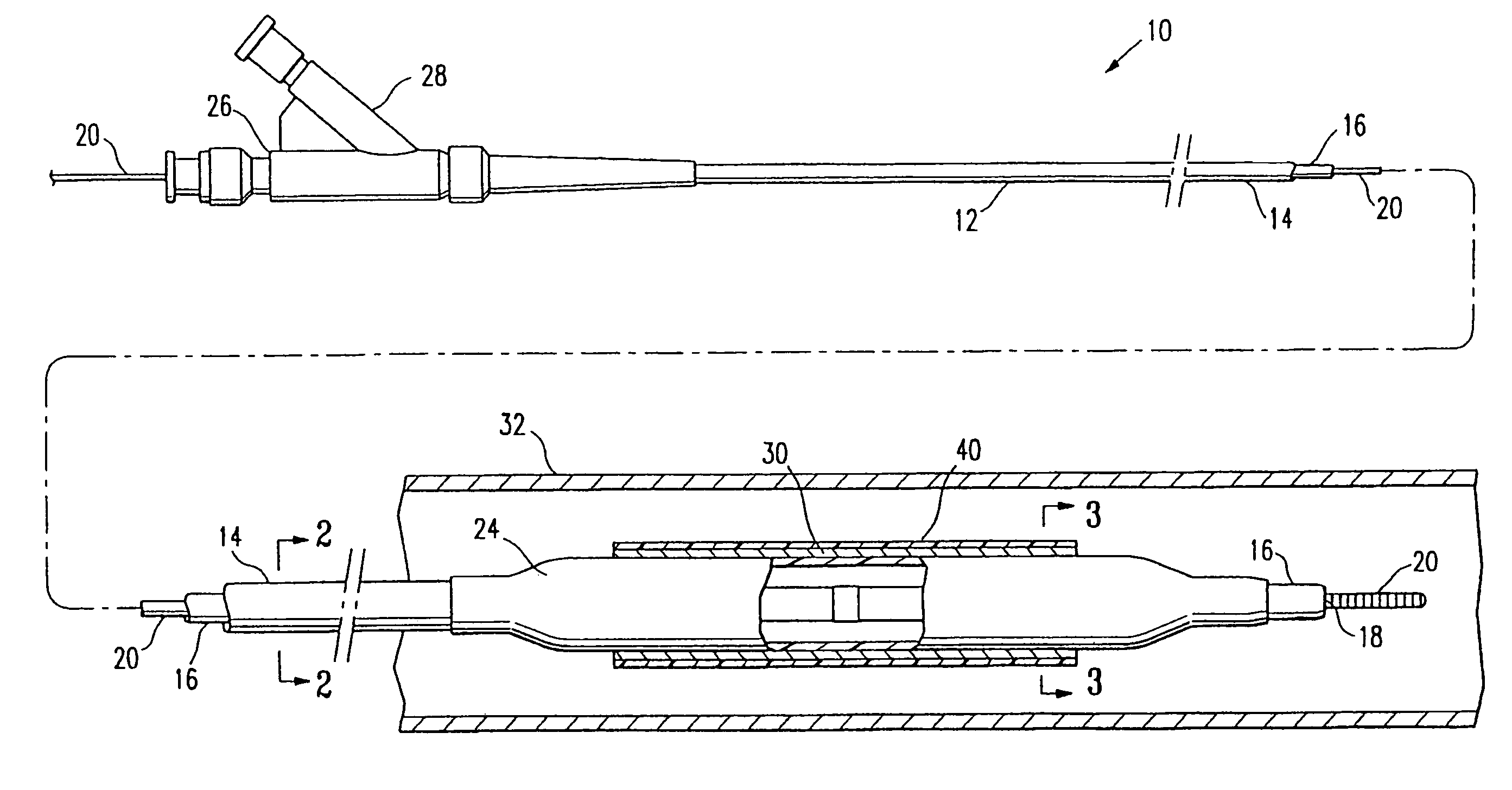 Medical device formed of polyester copolymer