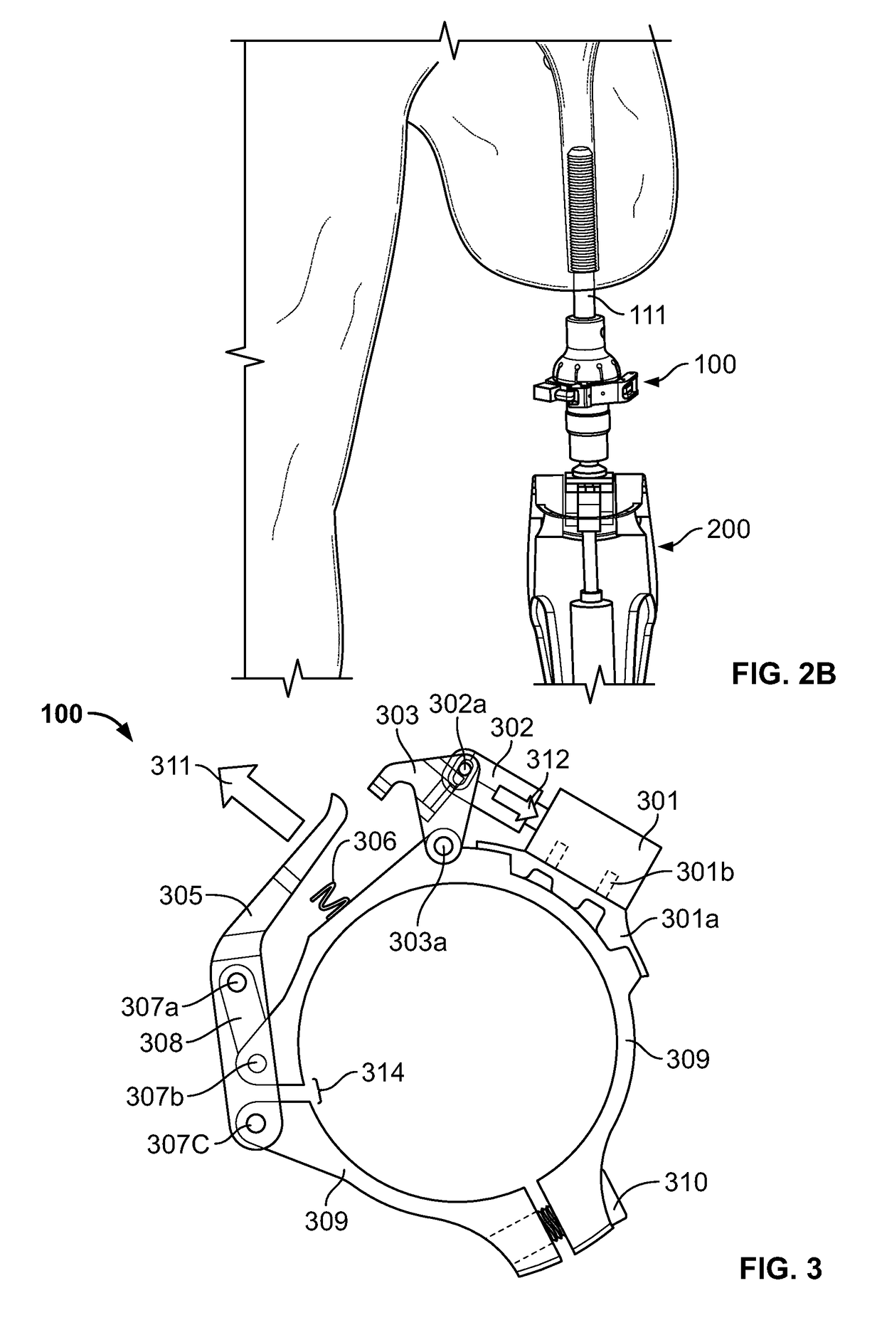 Safety Overload for Direct Skeletal Attachment