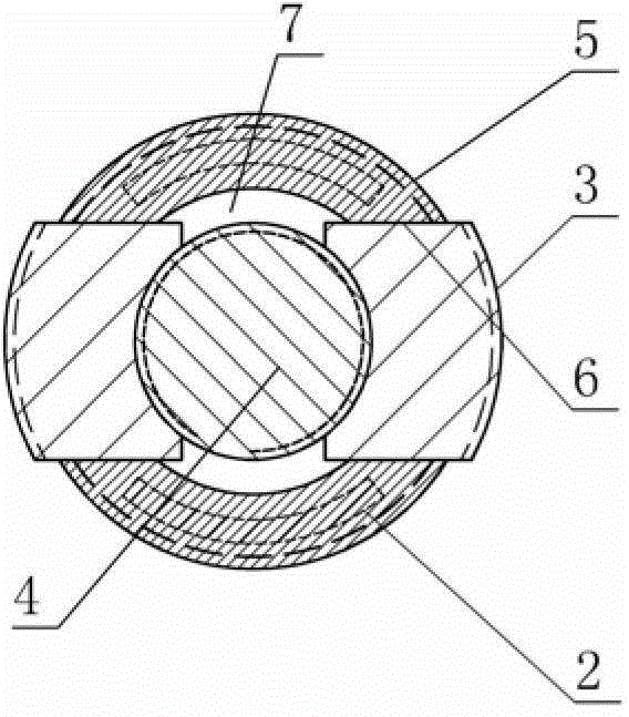 Thread non-continuous detachable expandable bone screw