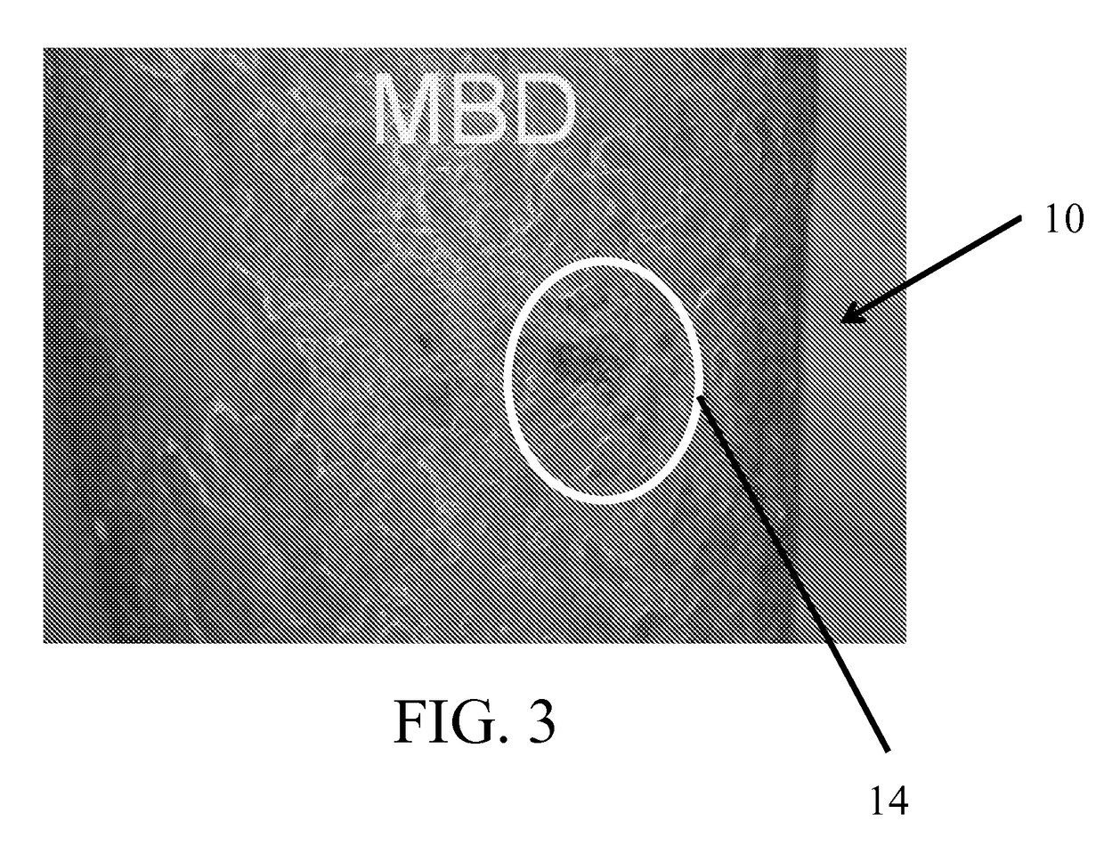 Plaque targeted sub-blistering dosimetry