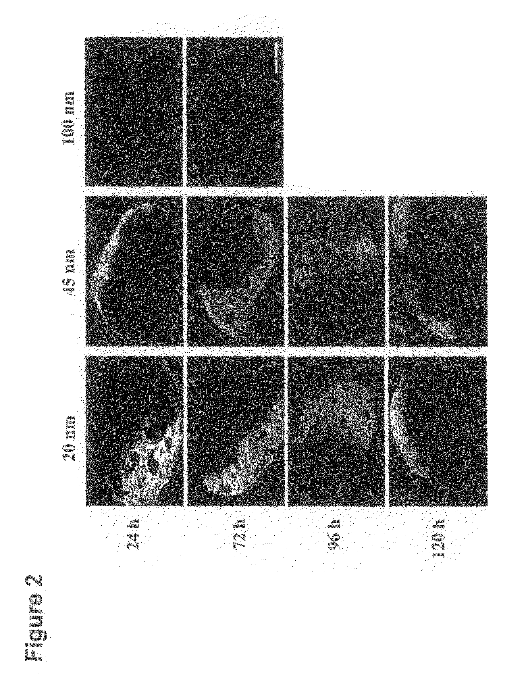 Nanoparticles for immunotherapy