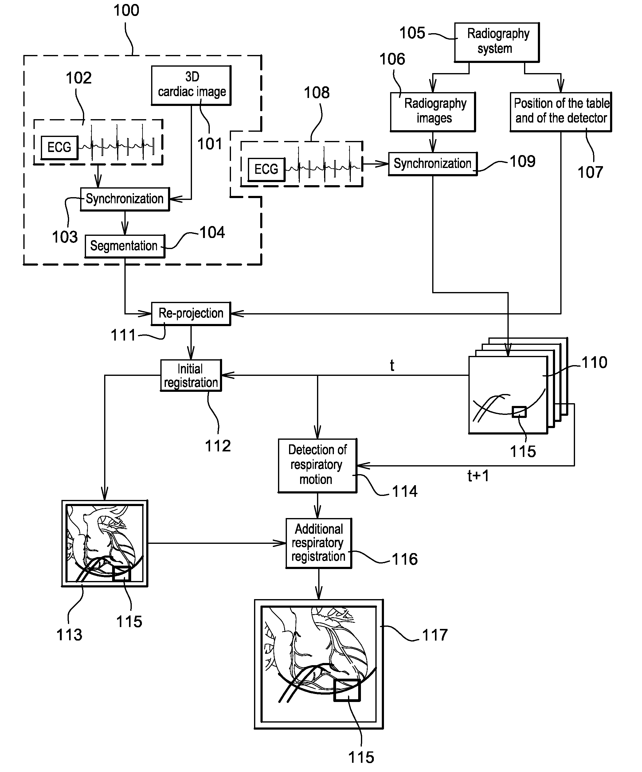 Method of detection and compensation for respiratory motion in radiography cardiac images synchronized with an electrocardiogram signal