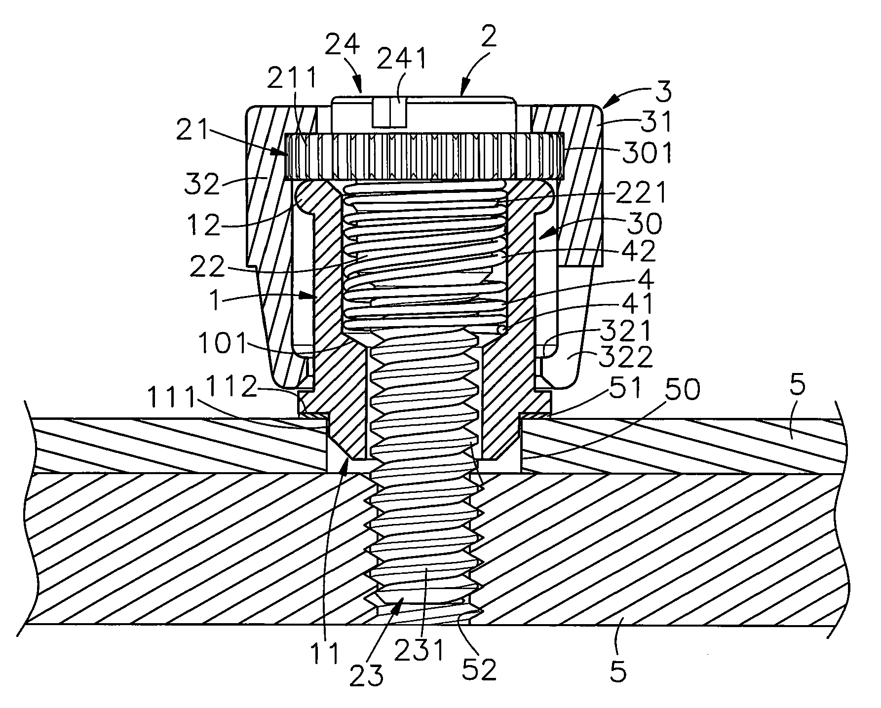 Metal plate member fixation device installation method