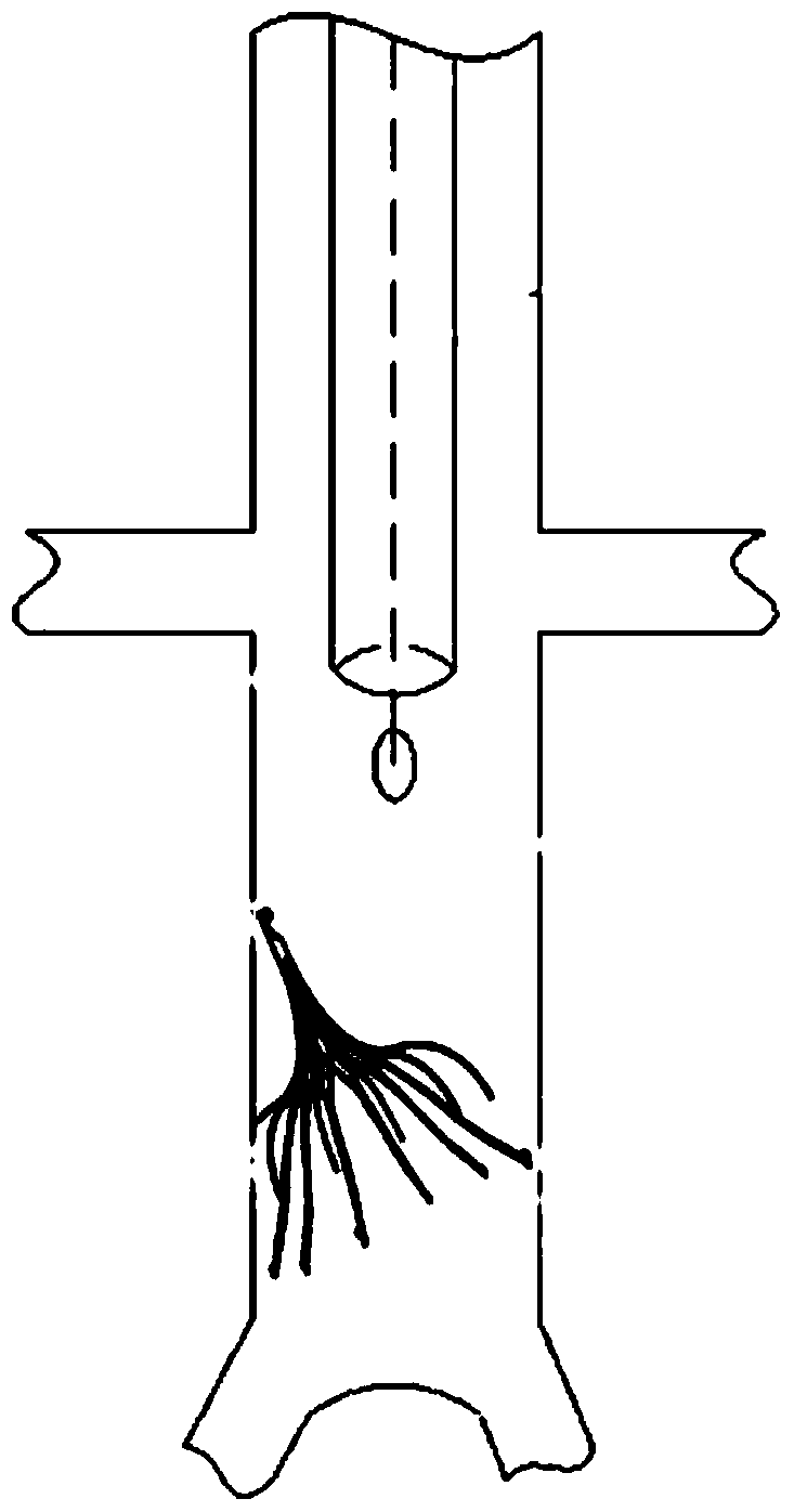 a thrombus filter