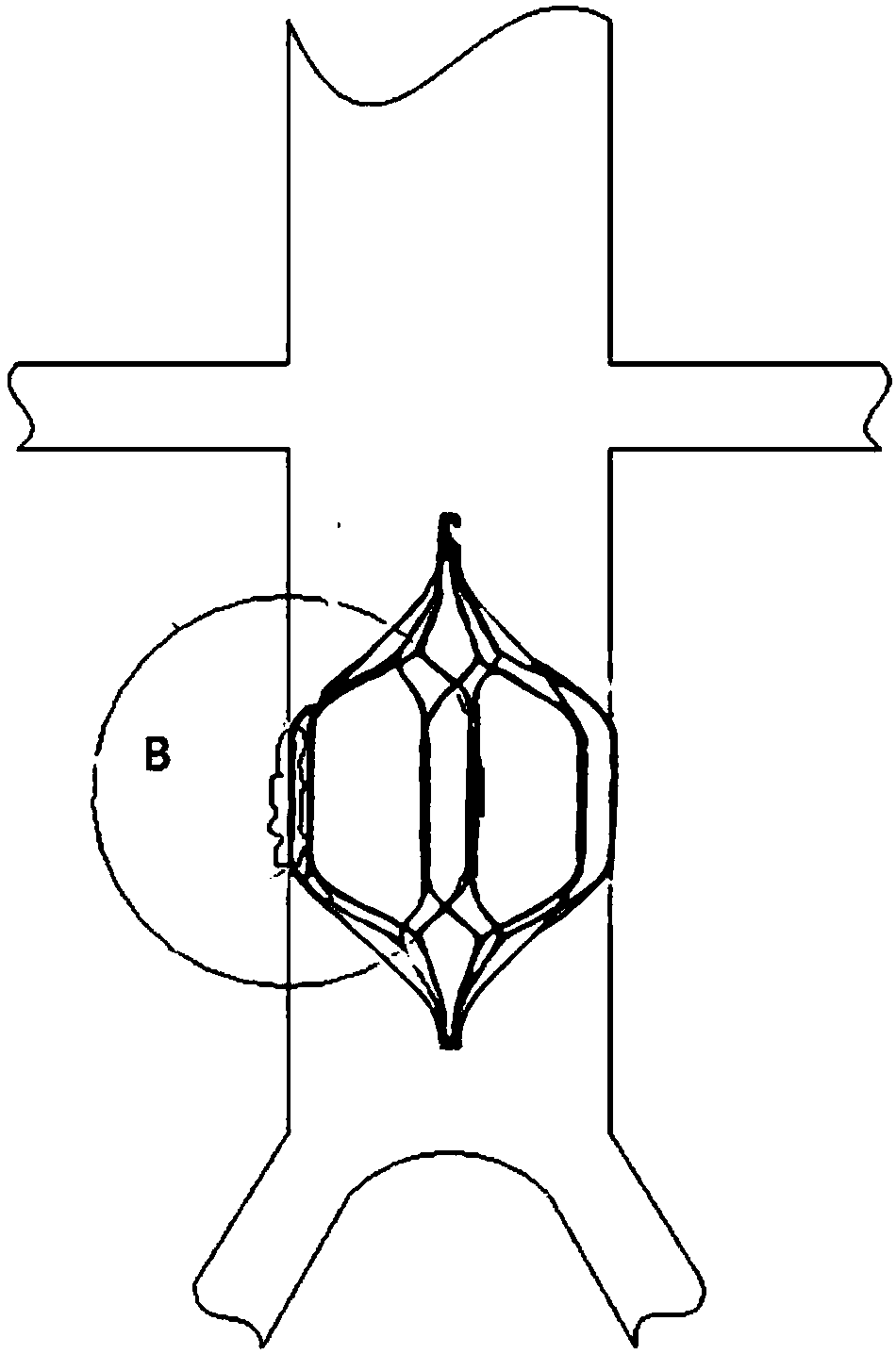 a thrombus filter