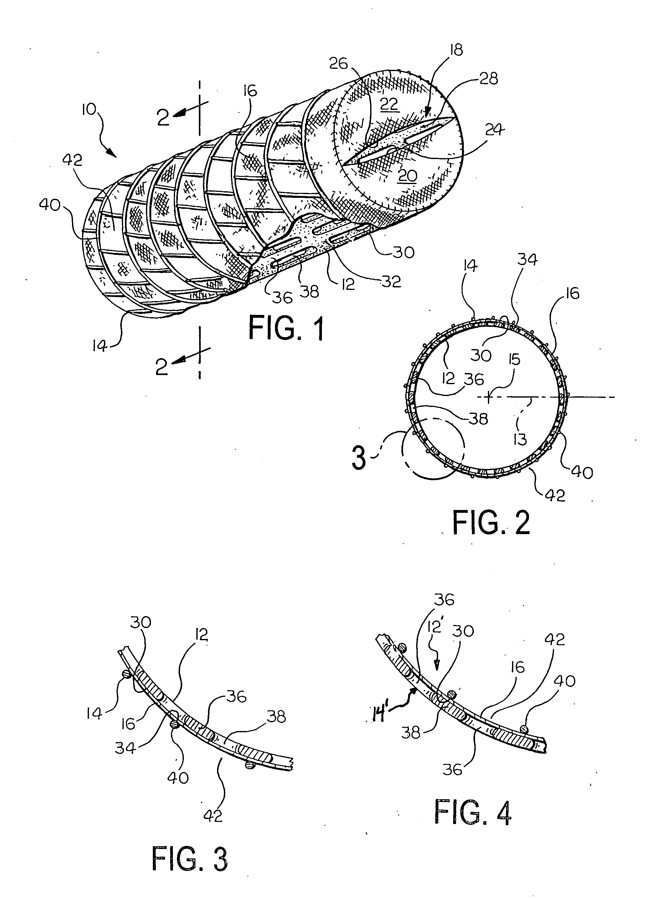 Prosthetic valve for implantation in a body vessel