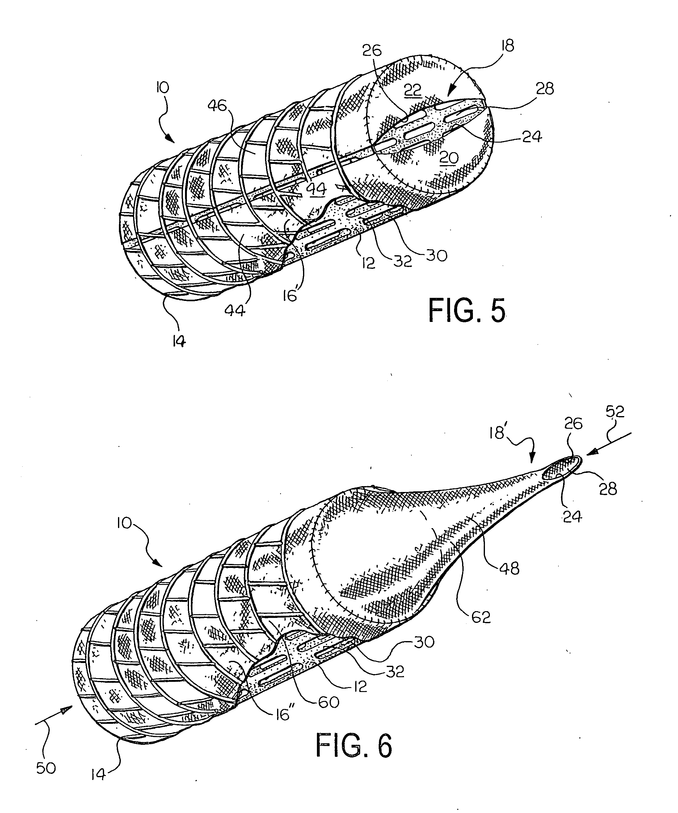 Prosthetic valve for implantation in a body vessel