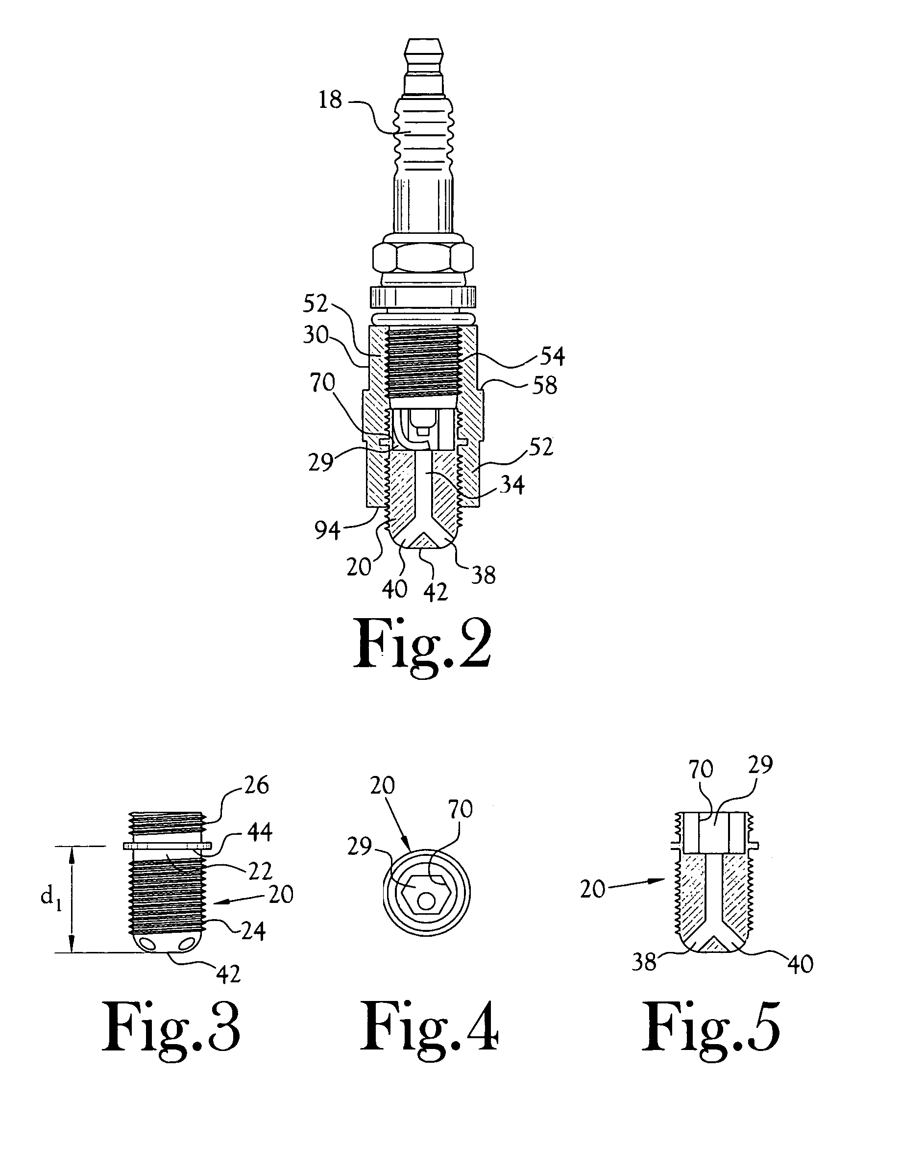 Spark ignition modifier module and method