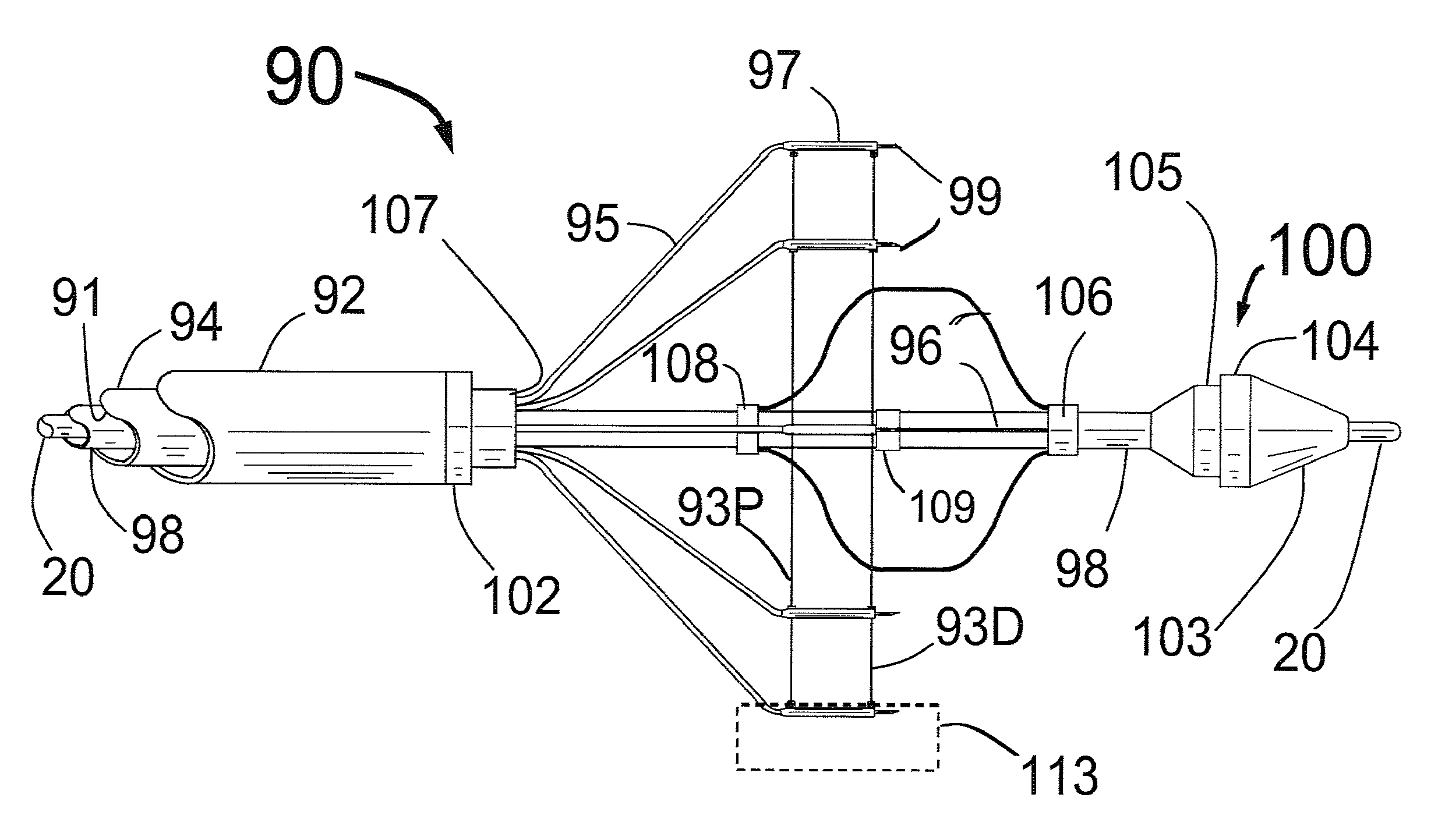 Expandable catheter system for peri-ostial injection and muscle and nerve fiber ablation