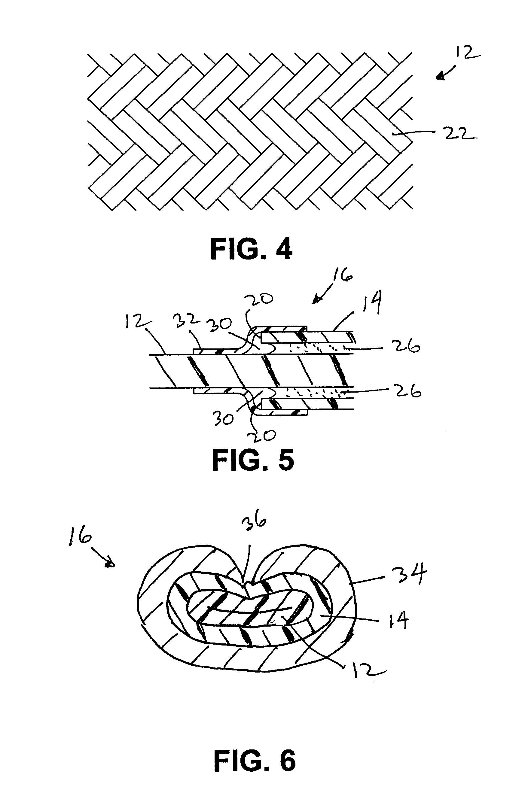 Elastic tie down