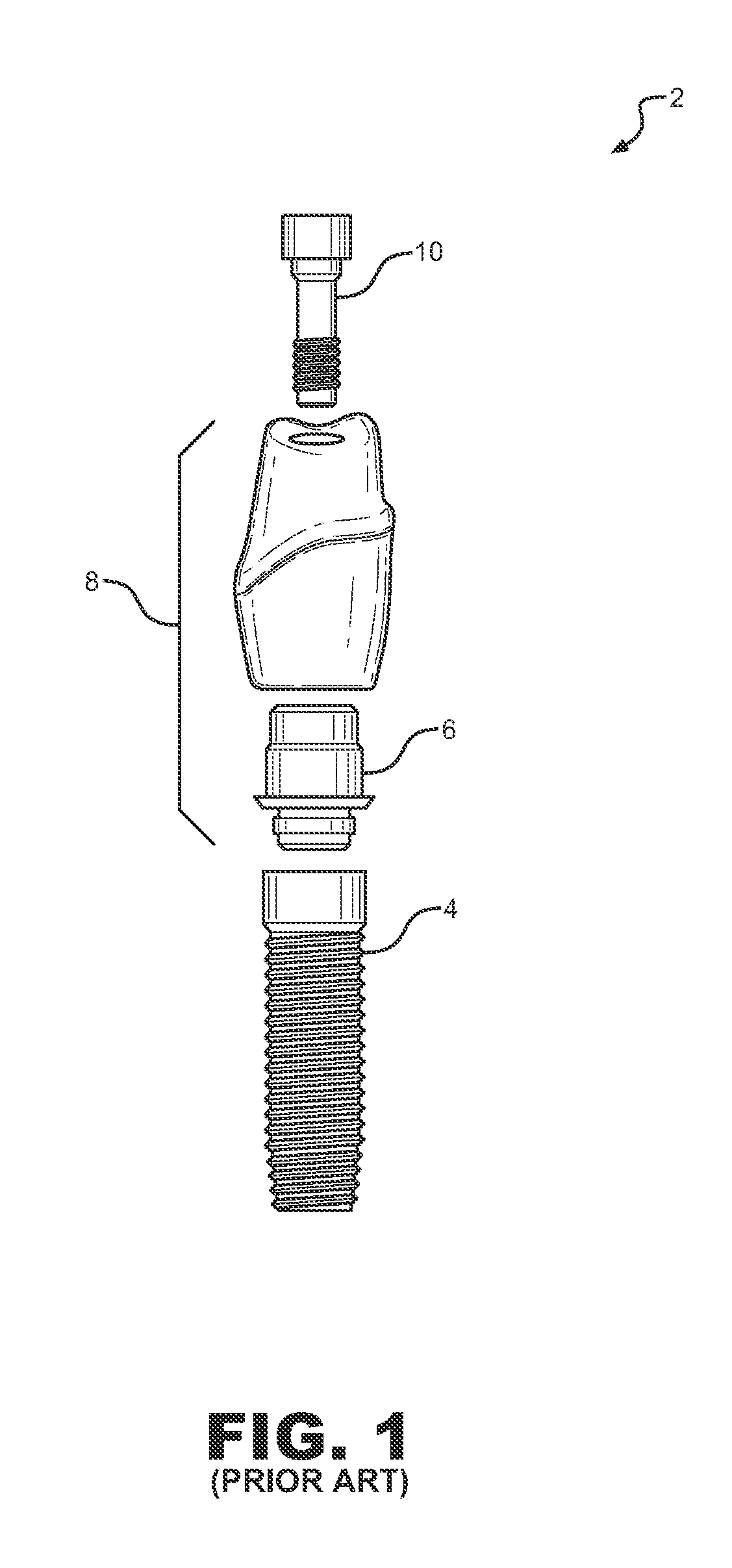 Dental Implant System and Method of Use