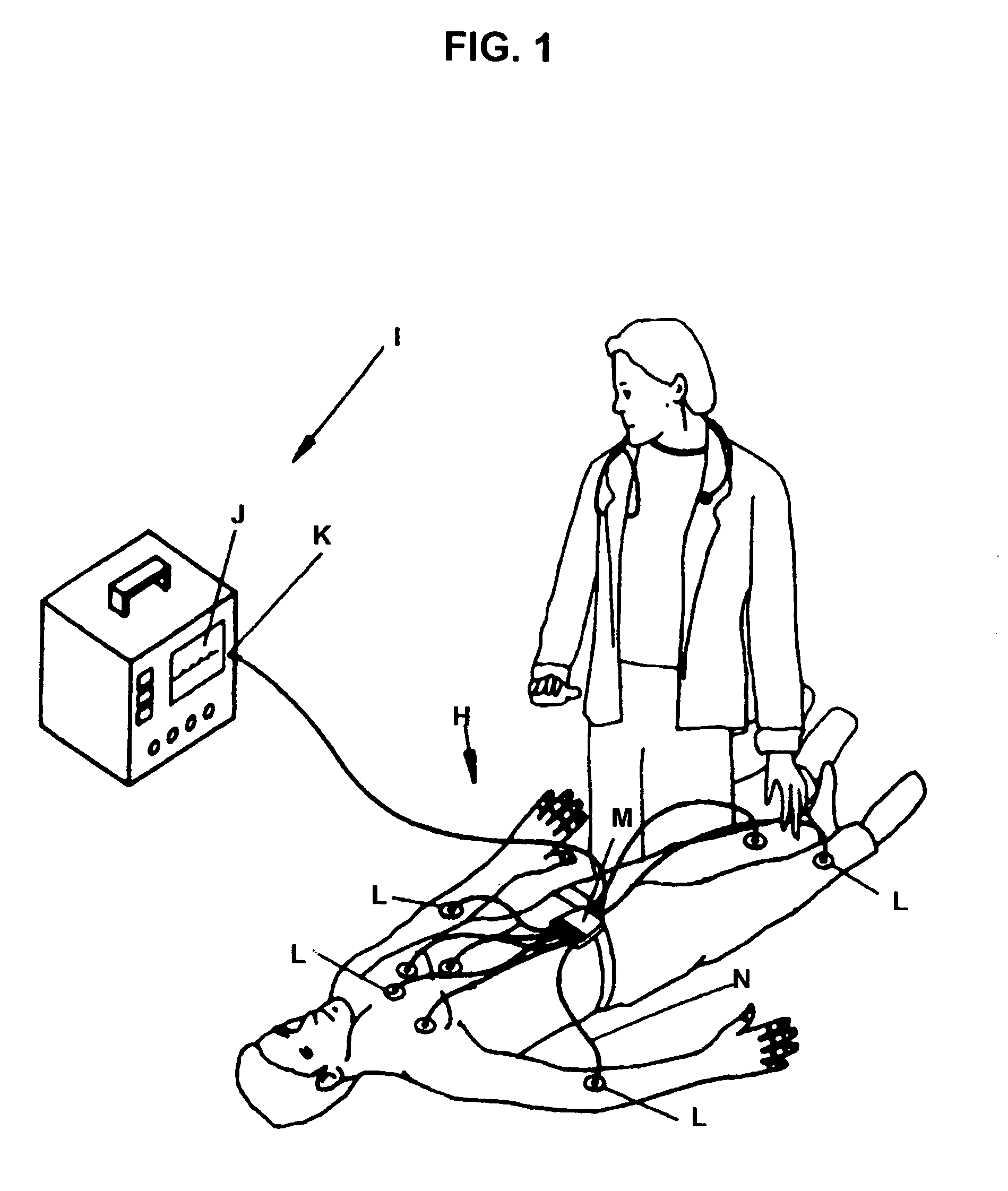 Simplified ECG monitoring system