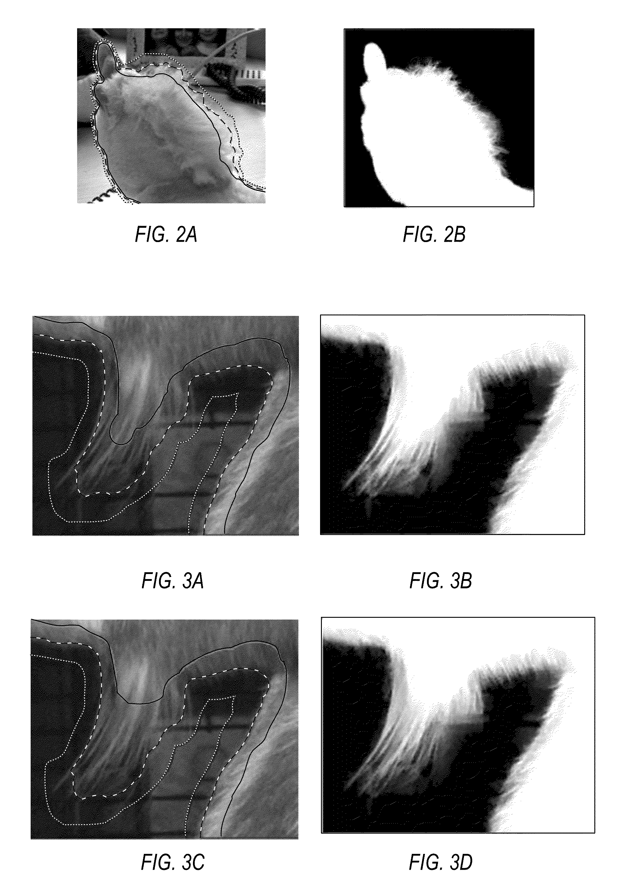 Adaptive trimap propagation for video matting