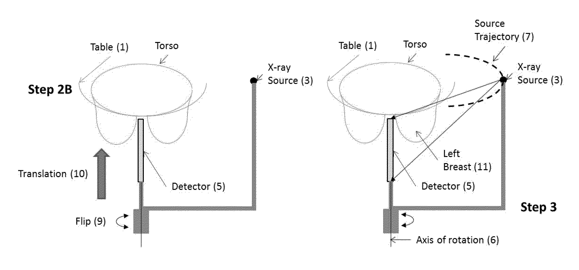 Apparatus and method for x-ray-based breast imaging