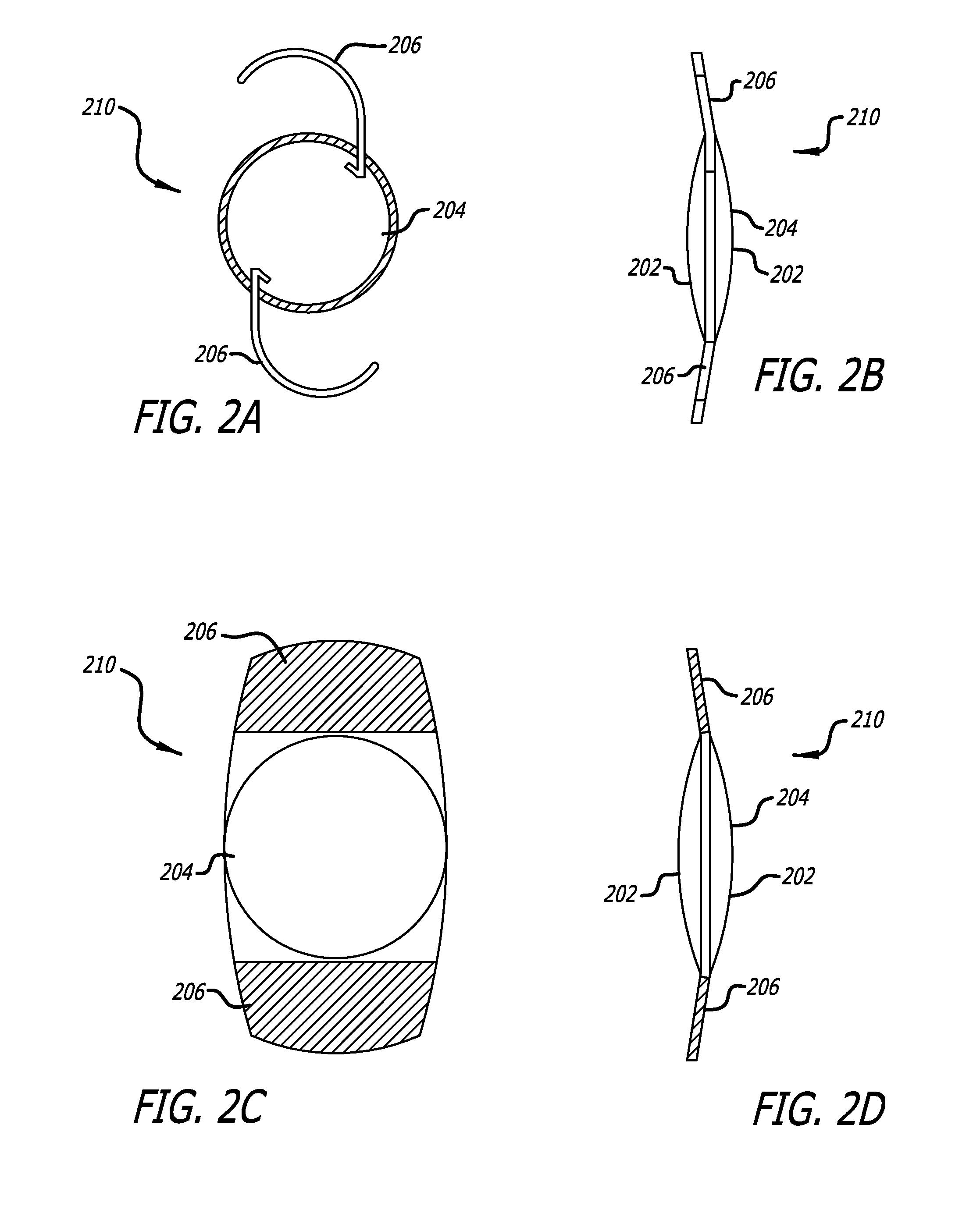 Optimized intraocular lens