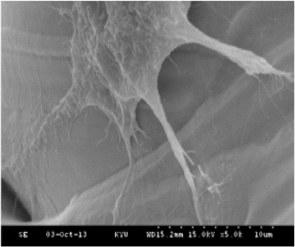 Intervertebral implant