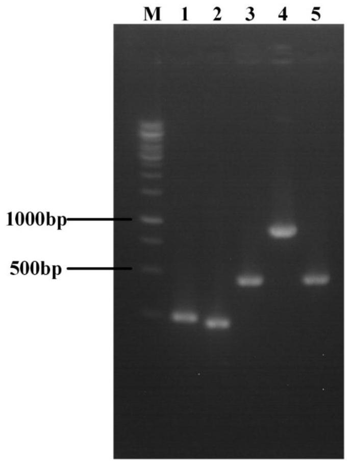 Engineering strain for xylose-induced production of N-acetylneuraminic acid and application of engineering strain