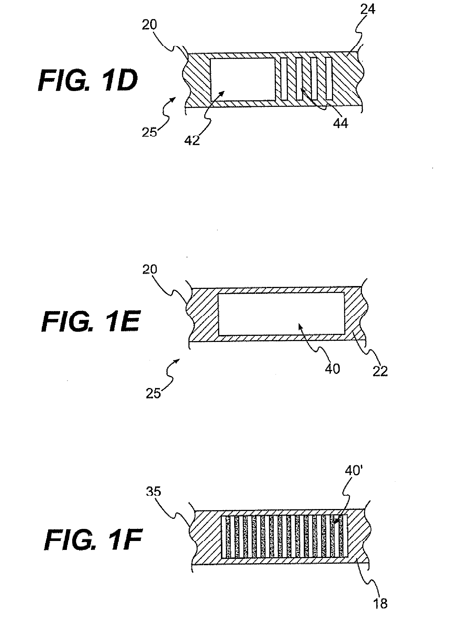 Textile-based electrode