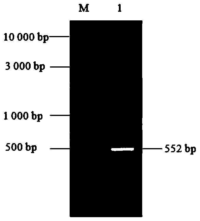 CTLA-4 (cytotoxic T-lymphocyte-associated protein 4) nanoantibody and preparation method and application thereof