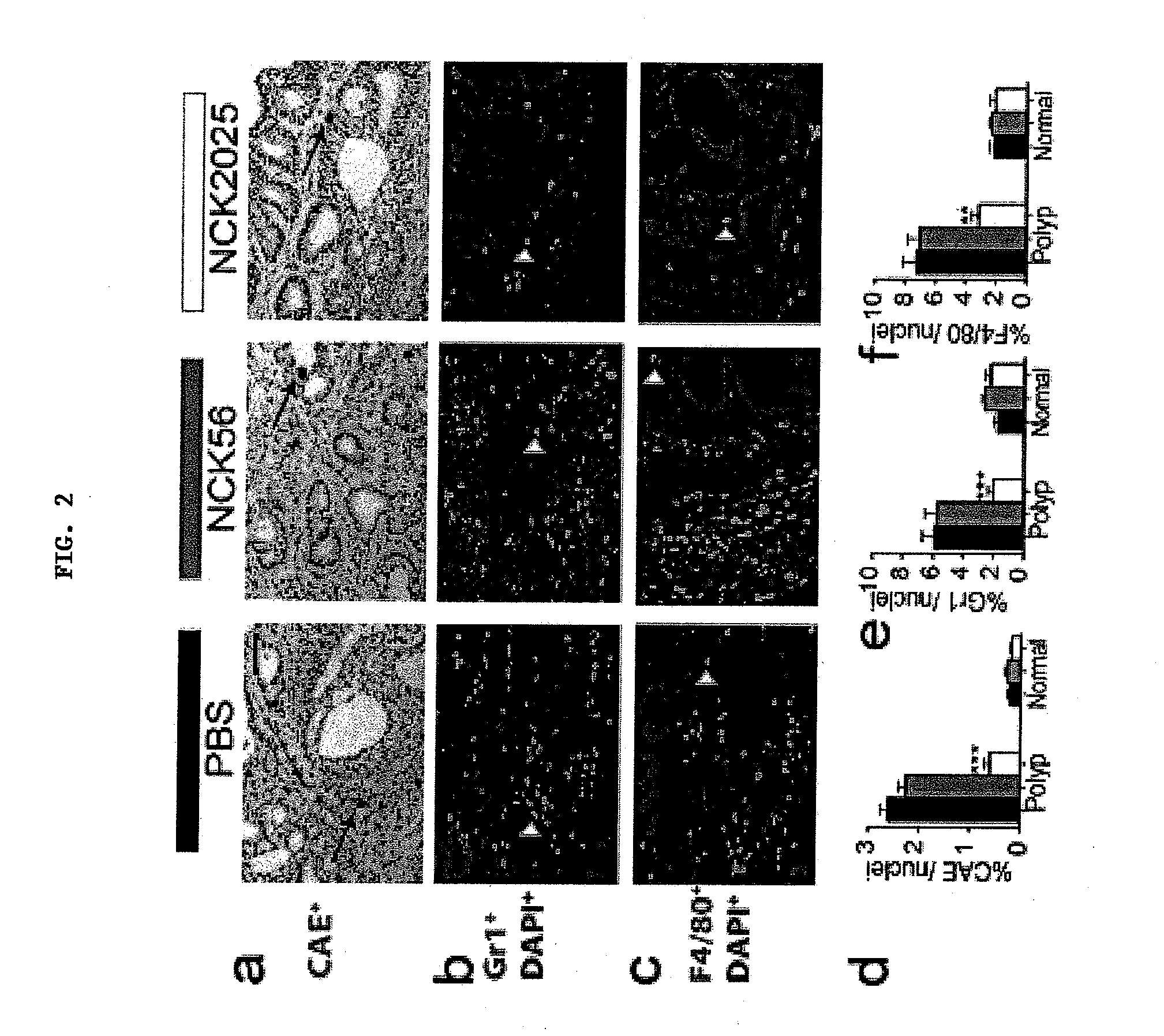 Methods to reduce polyposis and colorectal cancer