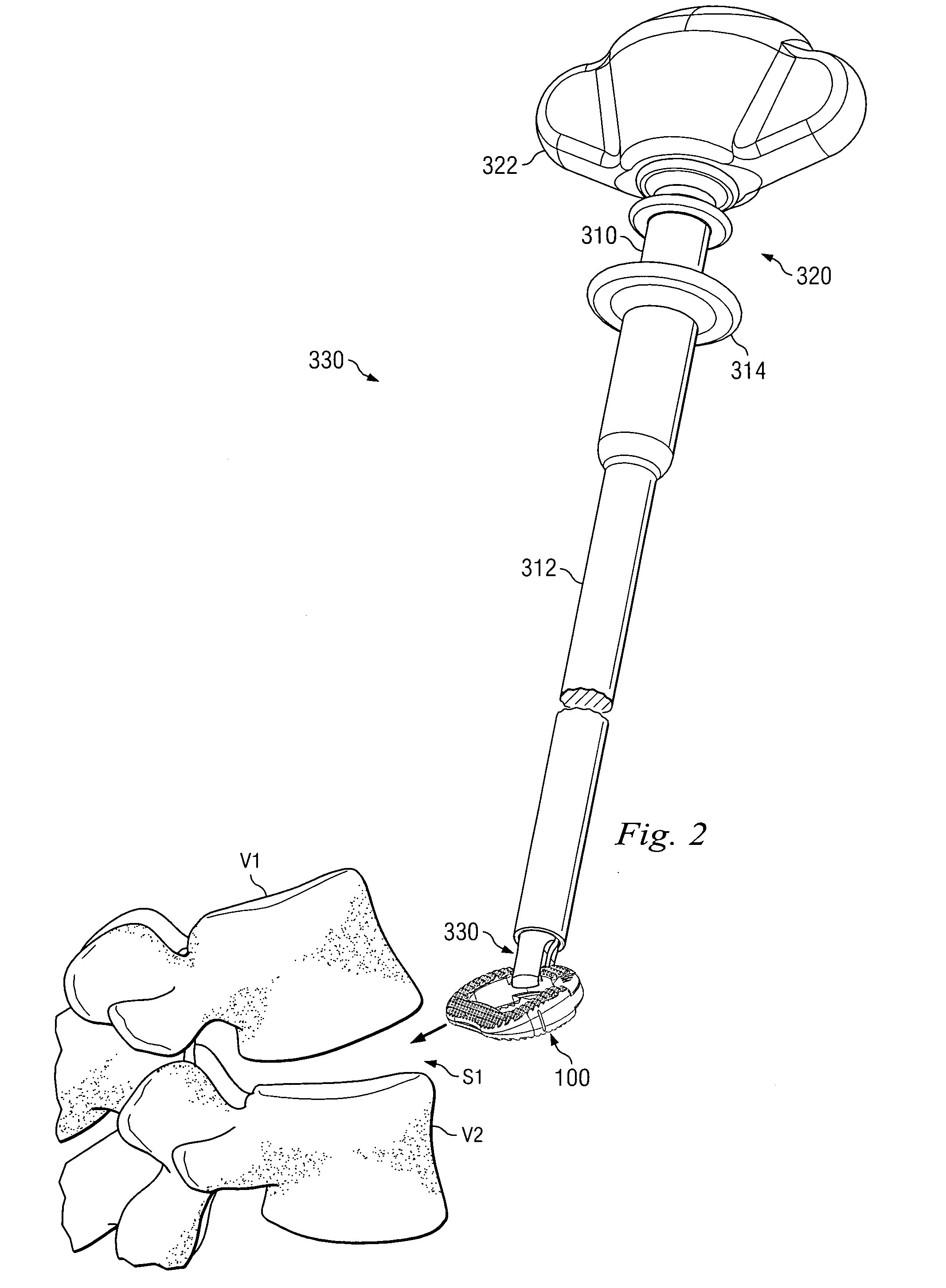 Vertebral implant and insertion tool