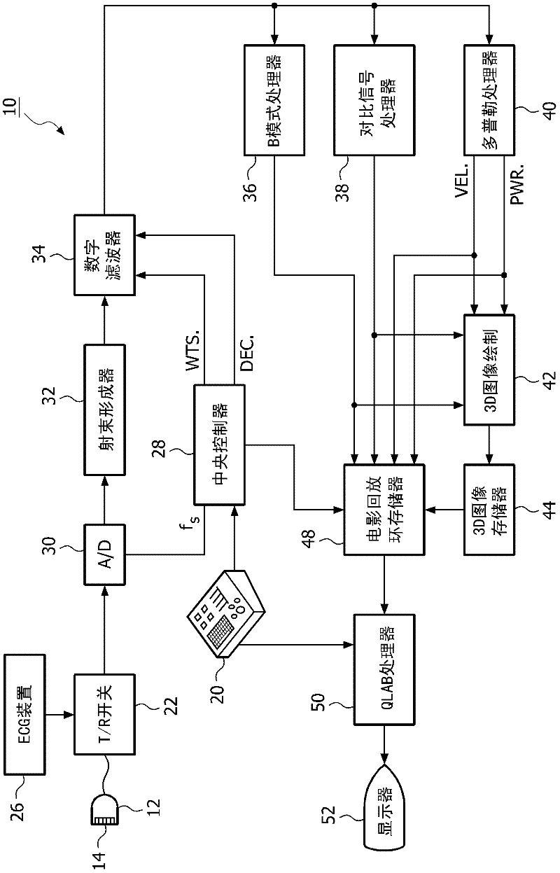 Contrast-enhanced ultrasound assessment of liver blood flow for monitoring liver therapy