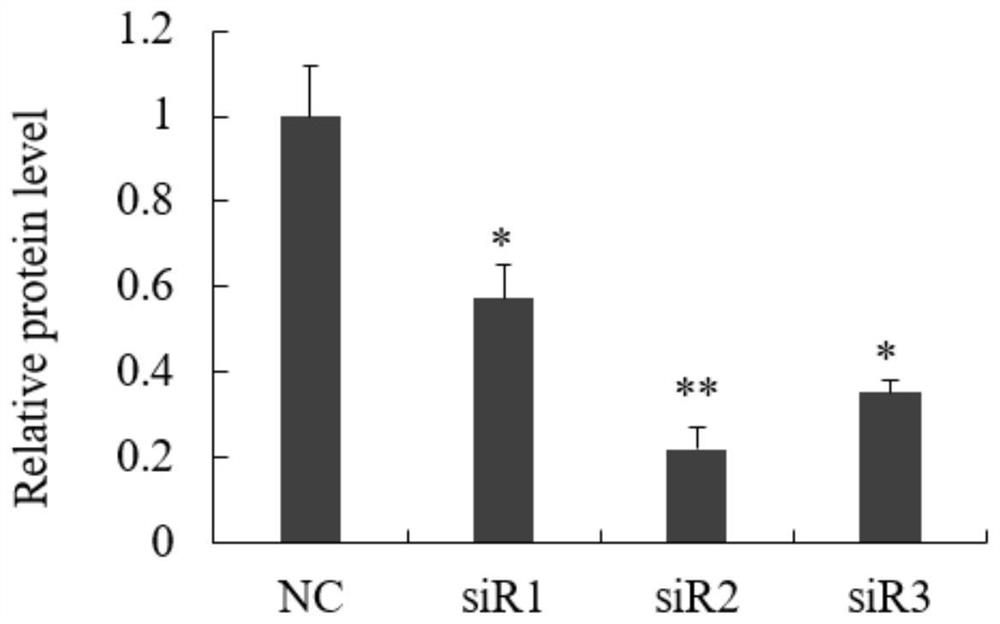 siRNA interfering with mroh7 gene expression and its application, interfering method and drug