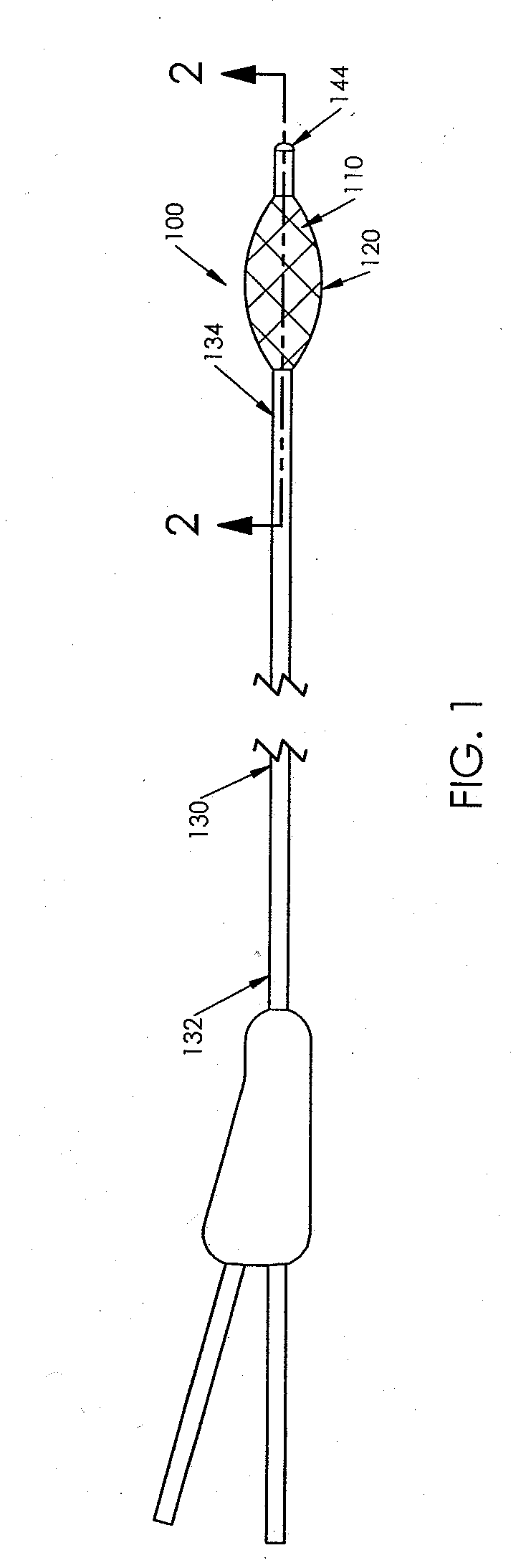 Method for Expanding a Vessel