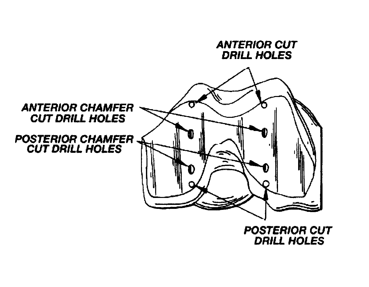 Methods and apparatus for improved cutting tools for resection