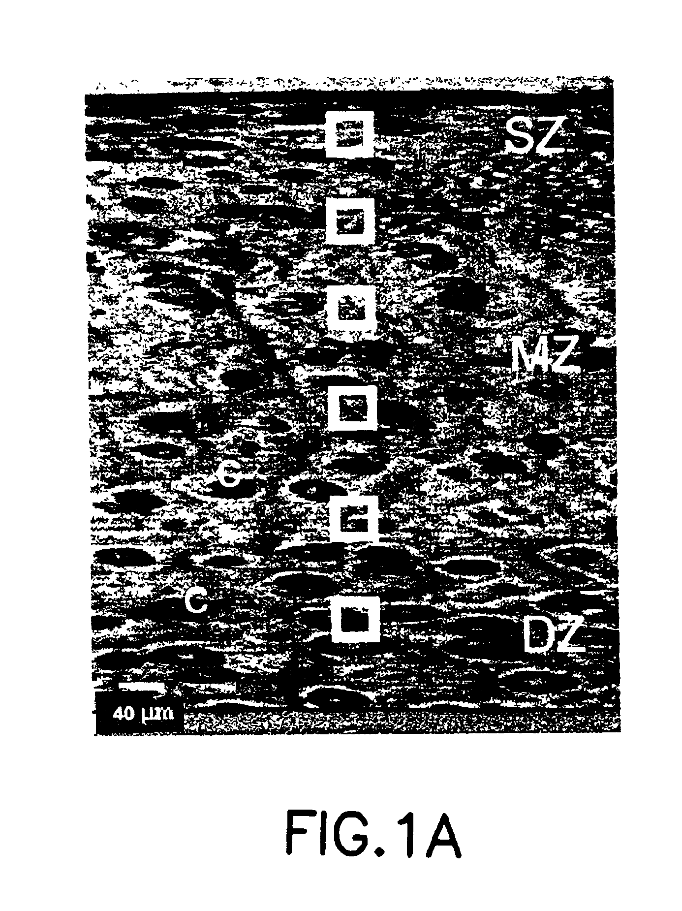 Determination of the ultrastructure of connective tissue by an infrared fiber-optic spectroscopic probe