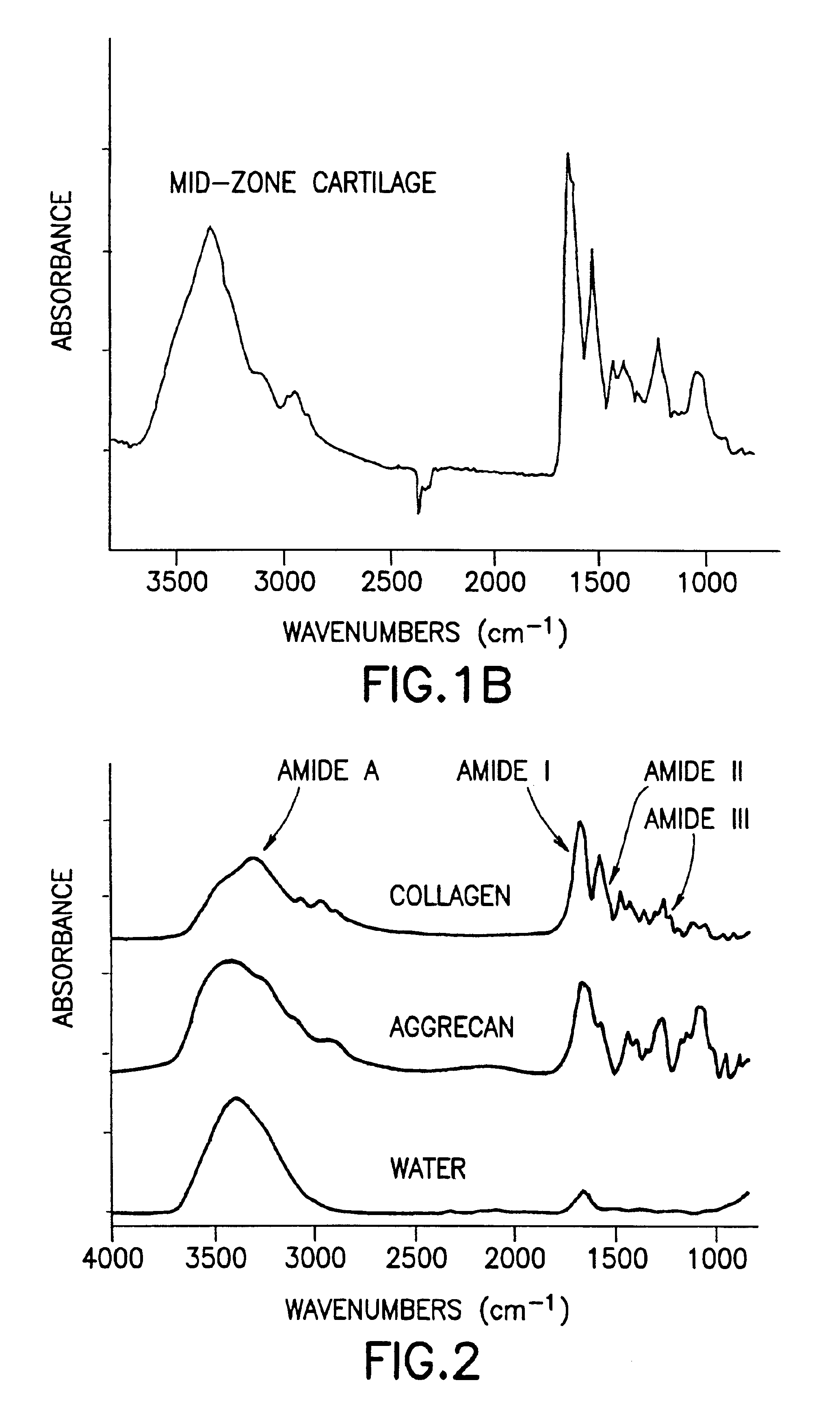 Determination of the ultrastructure of connective tissue by an infrared fiber-optic spectroscopic probe