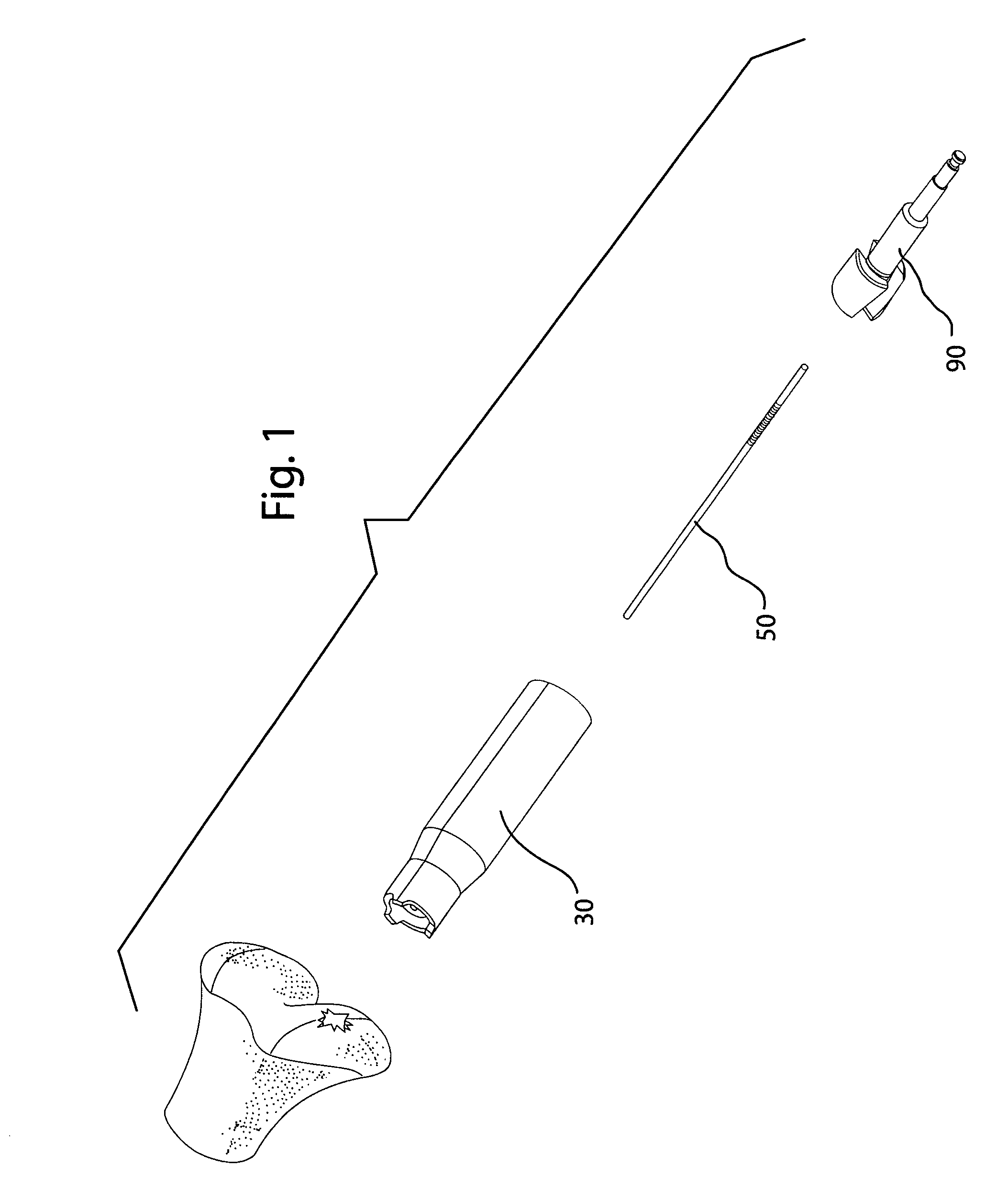 Surgical bone cutting assembly and method of using same