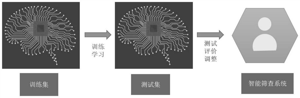 An intelligent screening system suitable for high myopia complicated by open-angle glaucoma and its establishment method