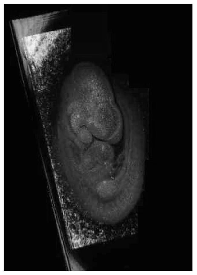 A Method for Enhancing the Contrast of Early Embryo Optical Coherence Tomography