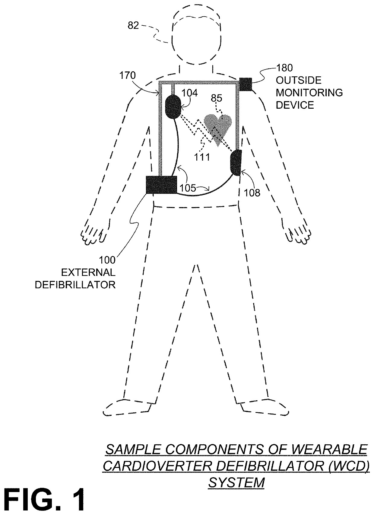 Wearable cardioverter defibrillator (WCD) system evaluating its ECG signals for noise according to tall peak counts