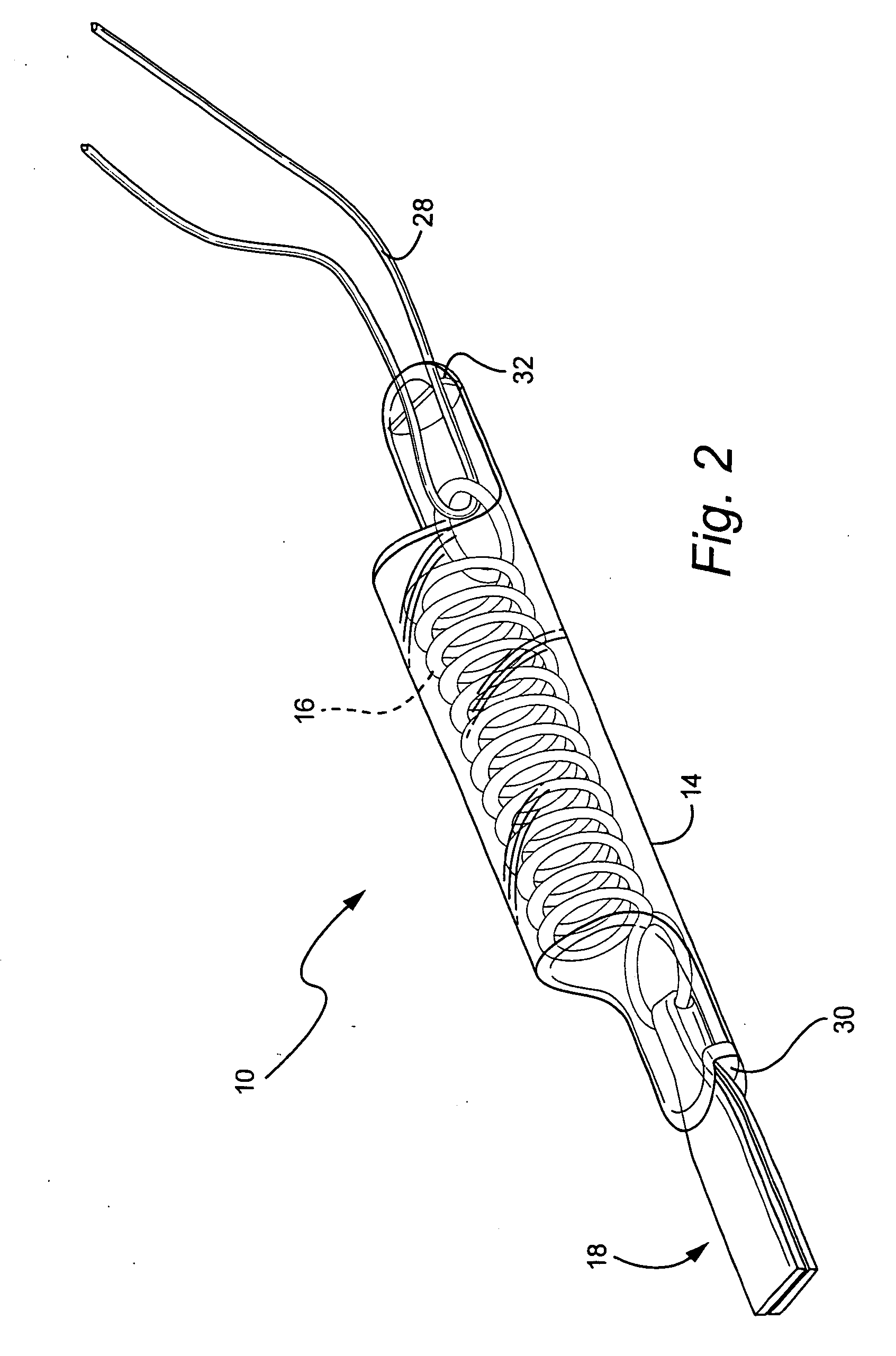 Extraocular muscle prosthesis