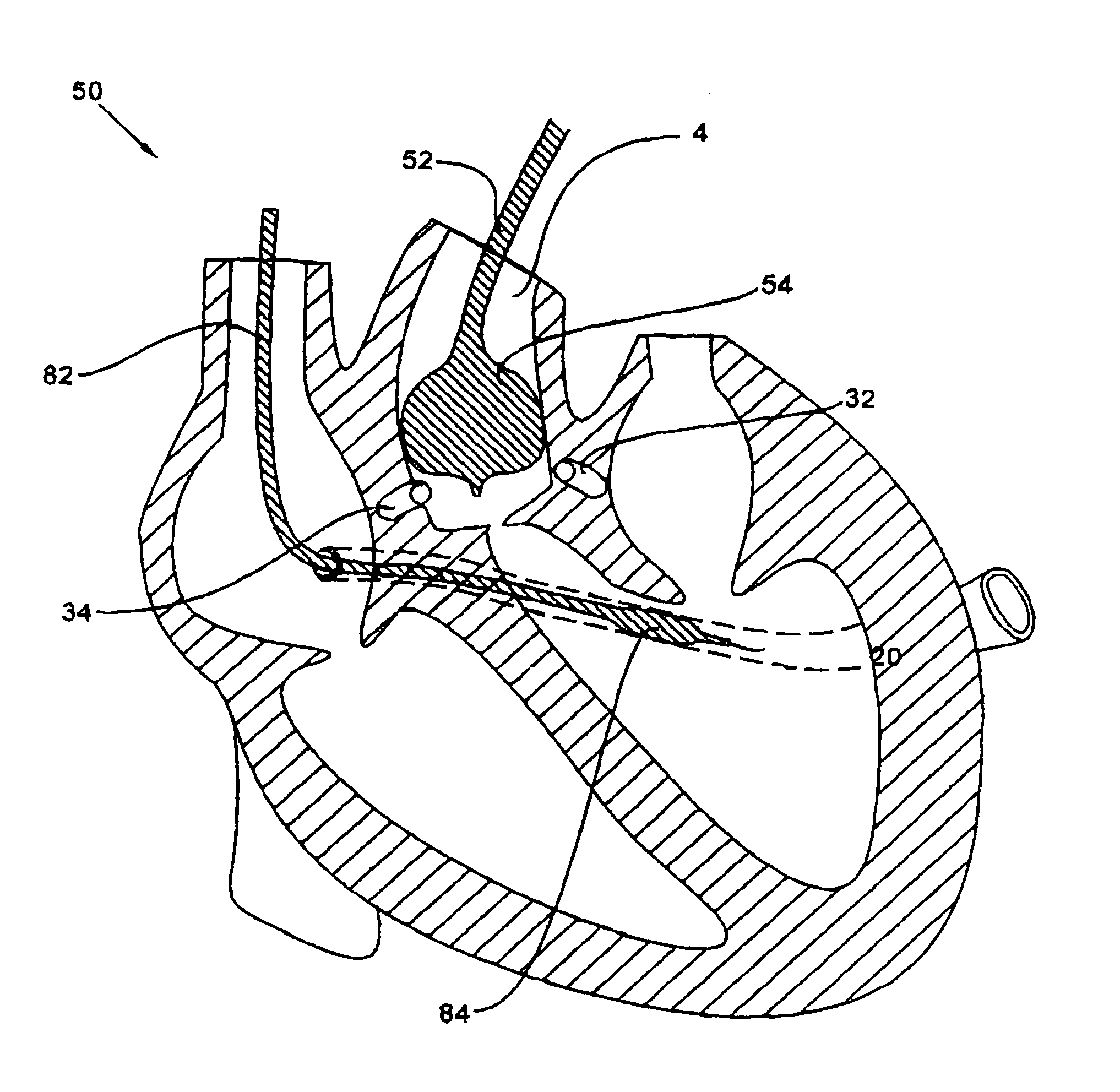 Conduit system for isolation of fluids in biological tissues