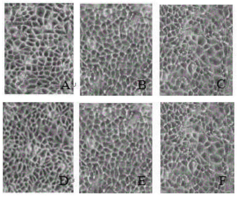 MDCK (Madin-Darby Canine Kidney) clone cell strains and application thereof