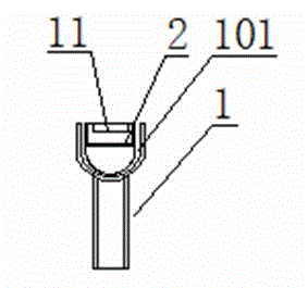 Minimal invasive fracture restoration and fixing bracket system