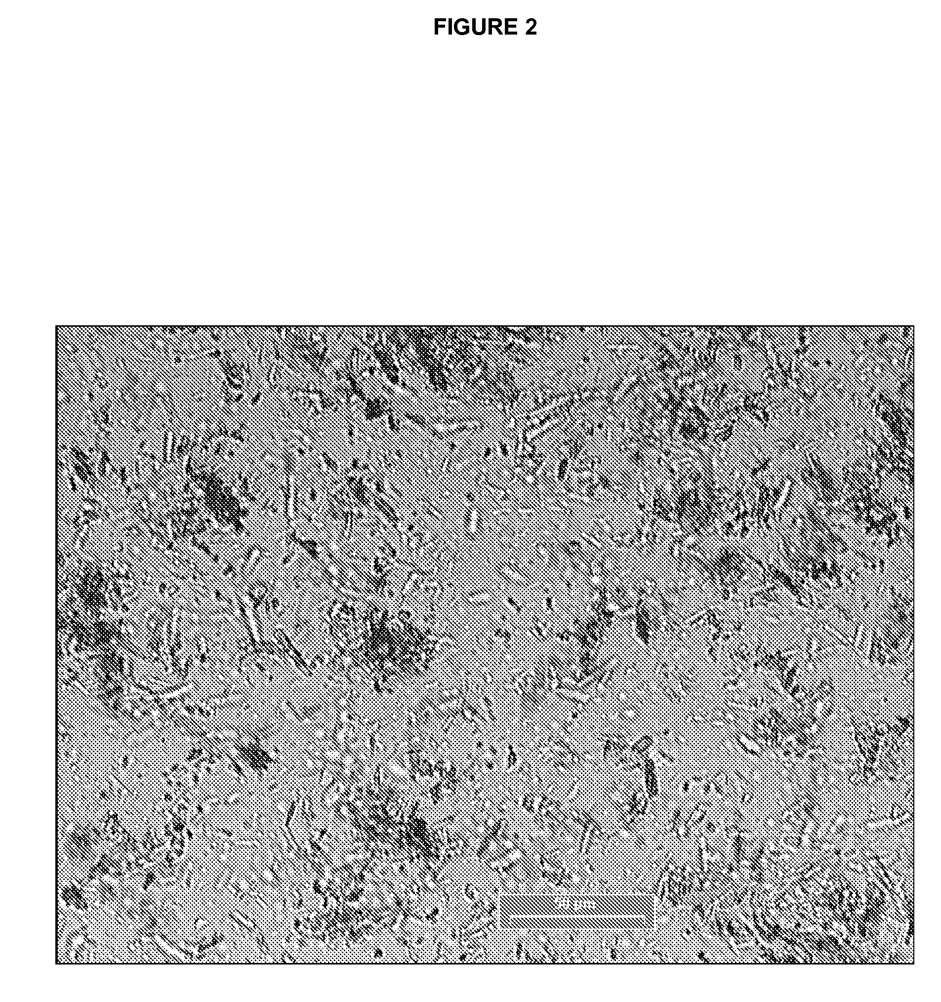 Specific salt, anhydrous and crystalline form of a dihydropteridione derivative