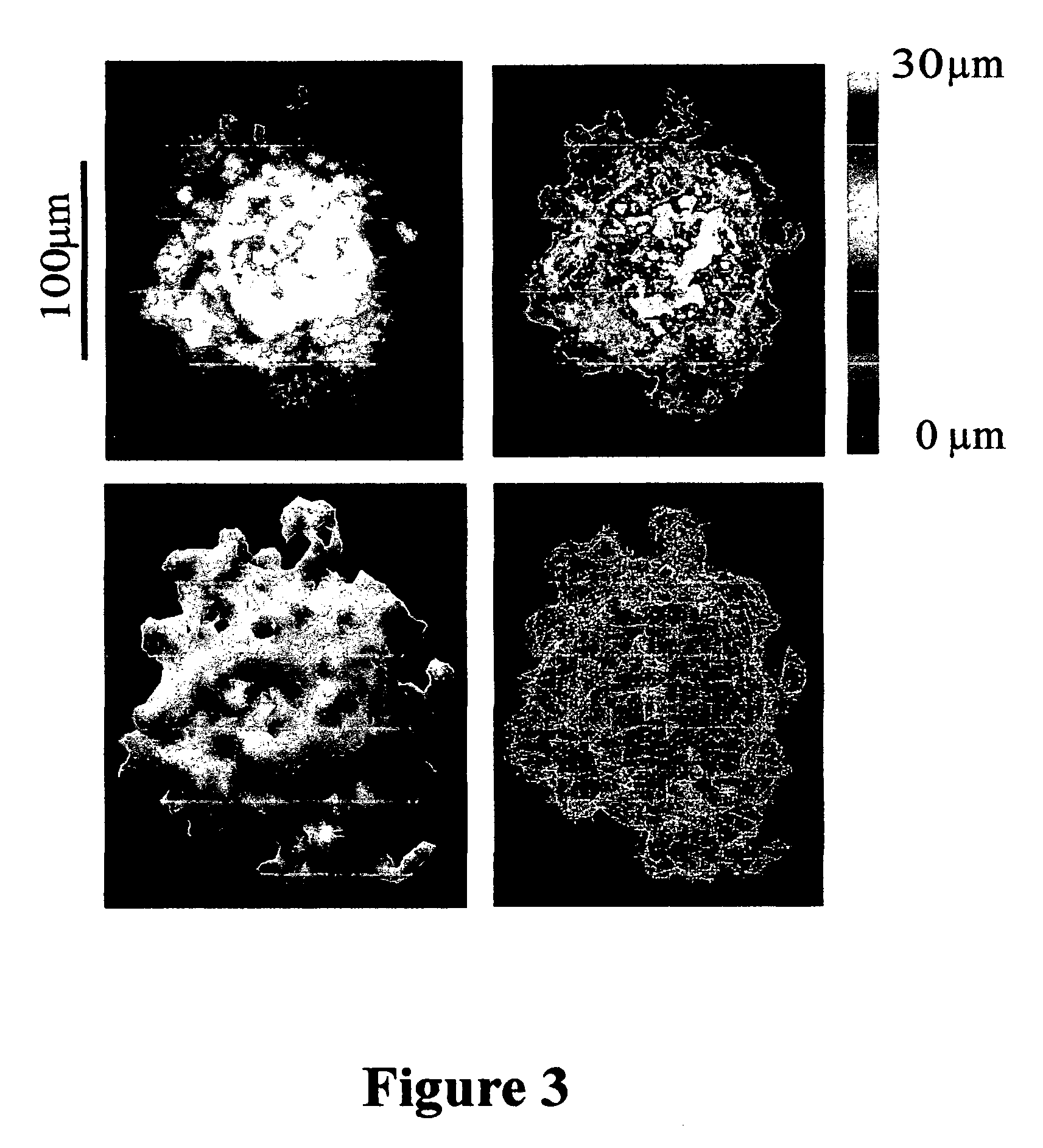 Apparatus and method to measure platelet contractility