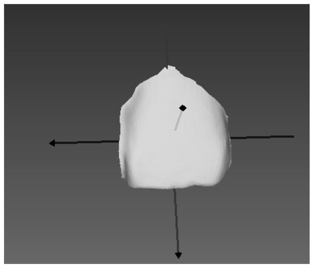 A Restoration Algorithm for Single Teeth Mesh Model