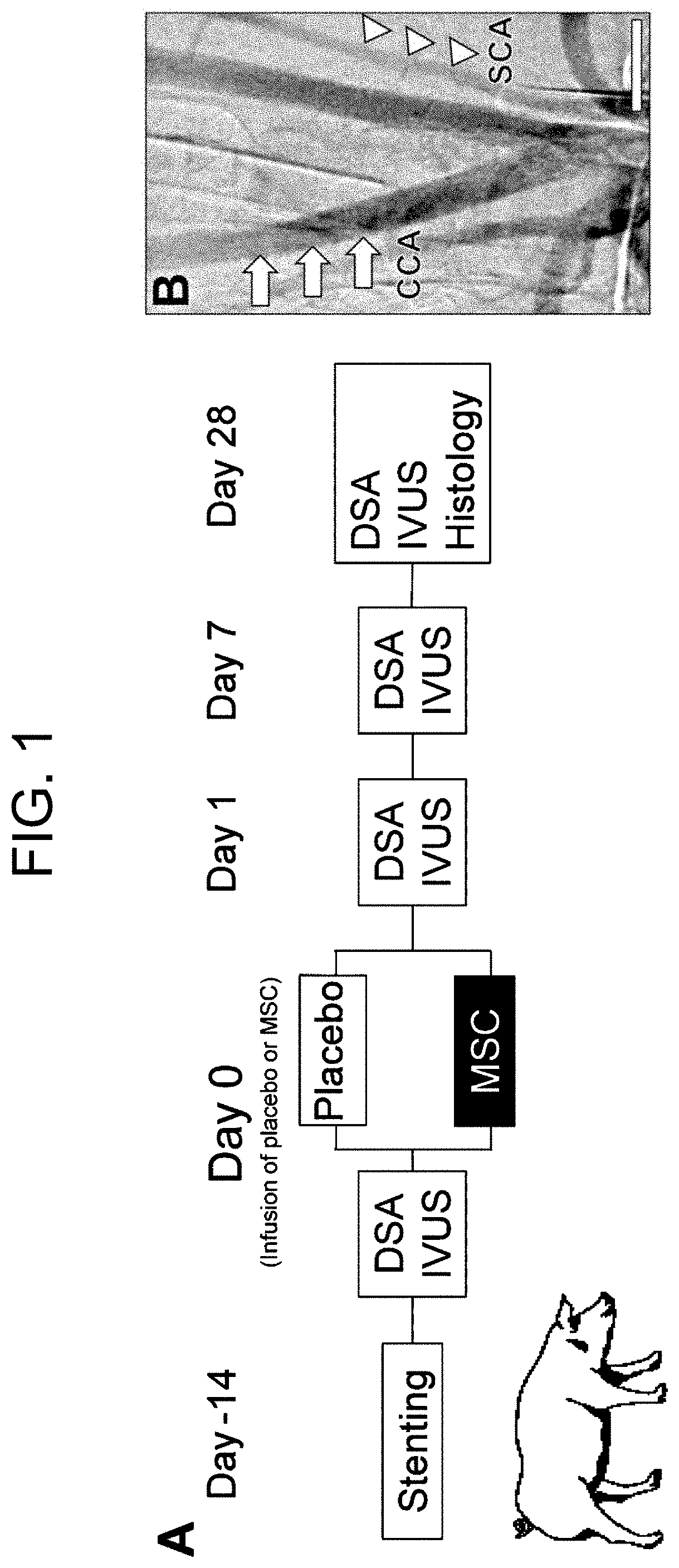 Pharmaceutical composition for preventing in-stent restenosis