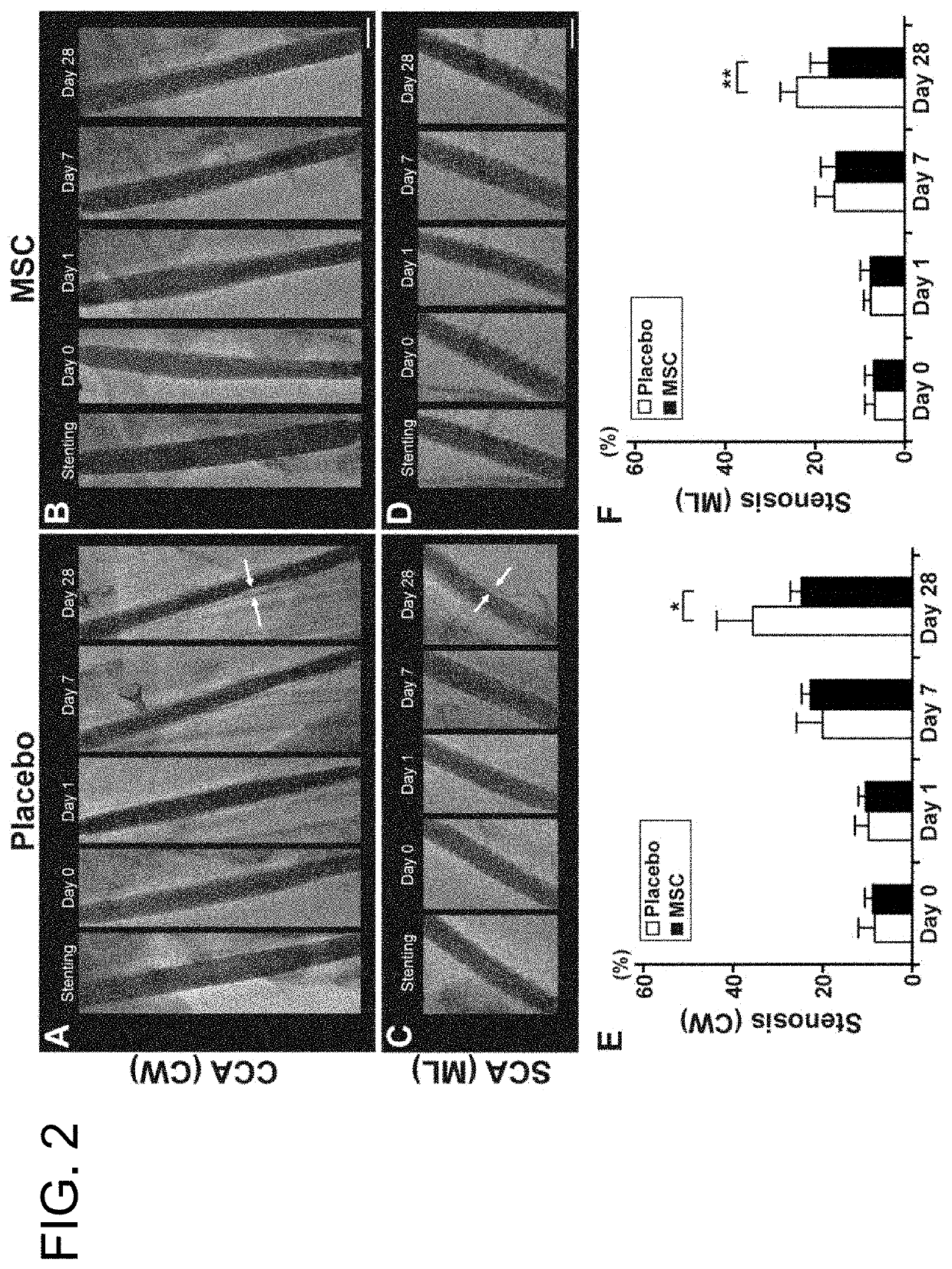 Pharmaceutical composition for preventing in-stent restenosis