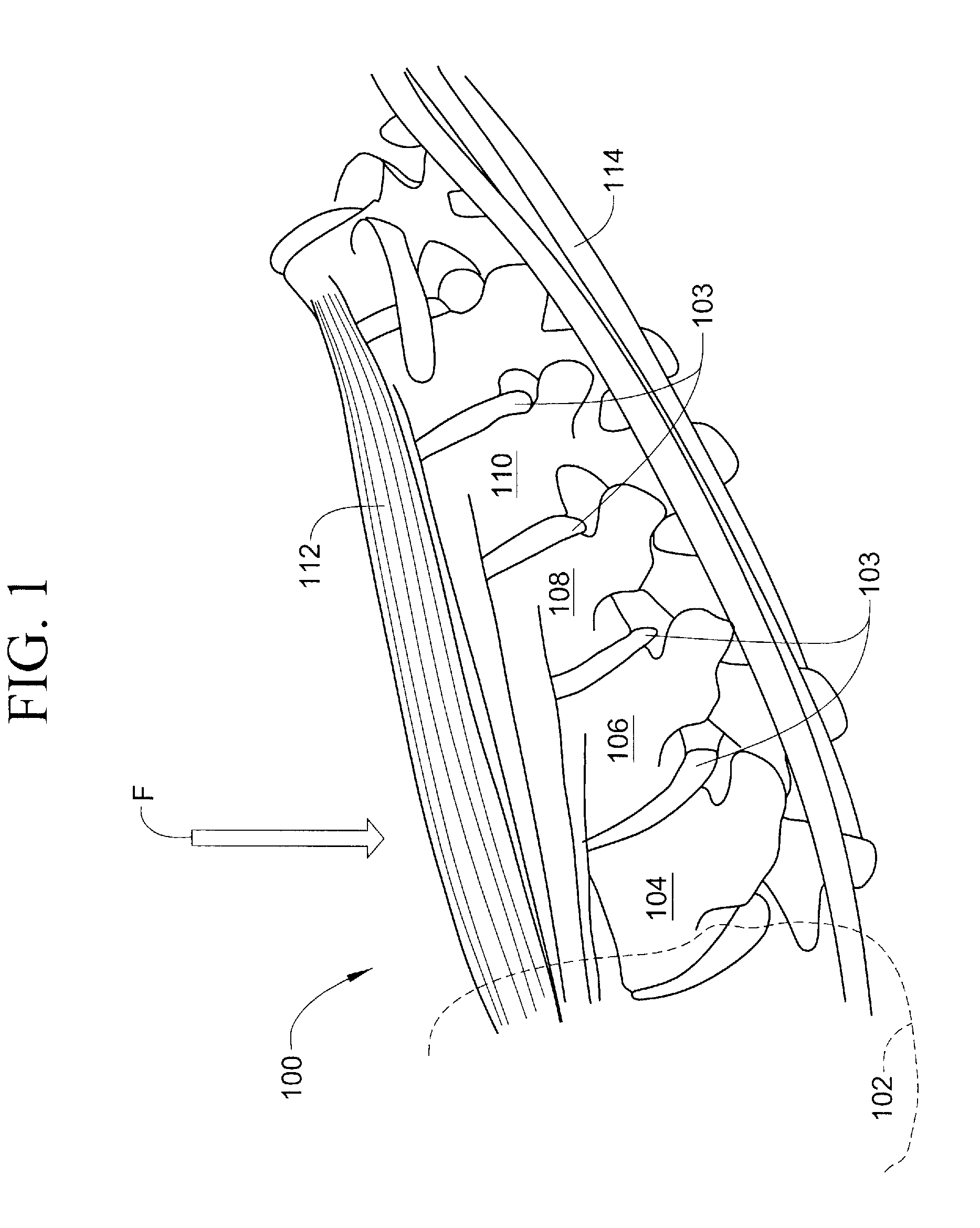 Method and apparatus for increasing effectiveness of abdominal exercises