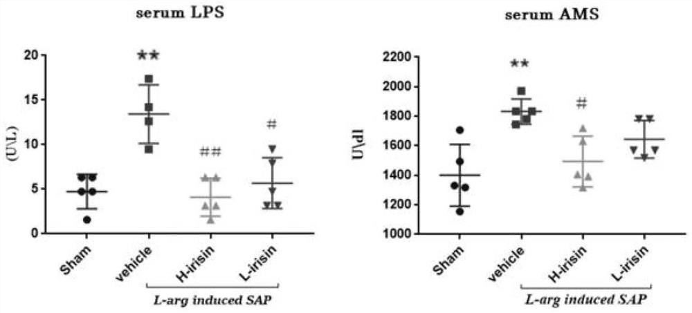 Application of irisin in the preparation of medicines for the prevention and treatment of severe acute pancreatitis